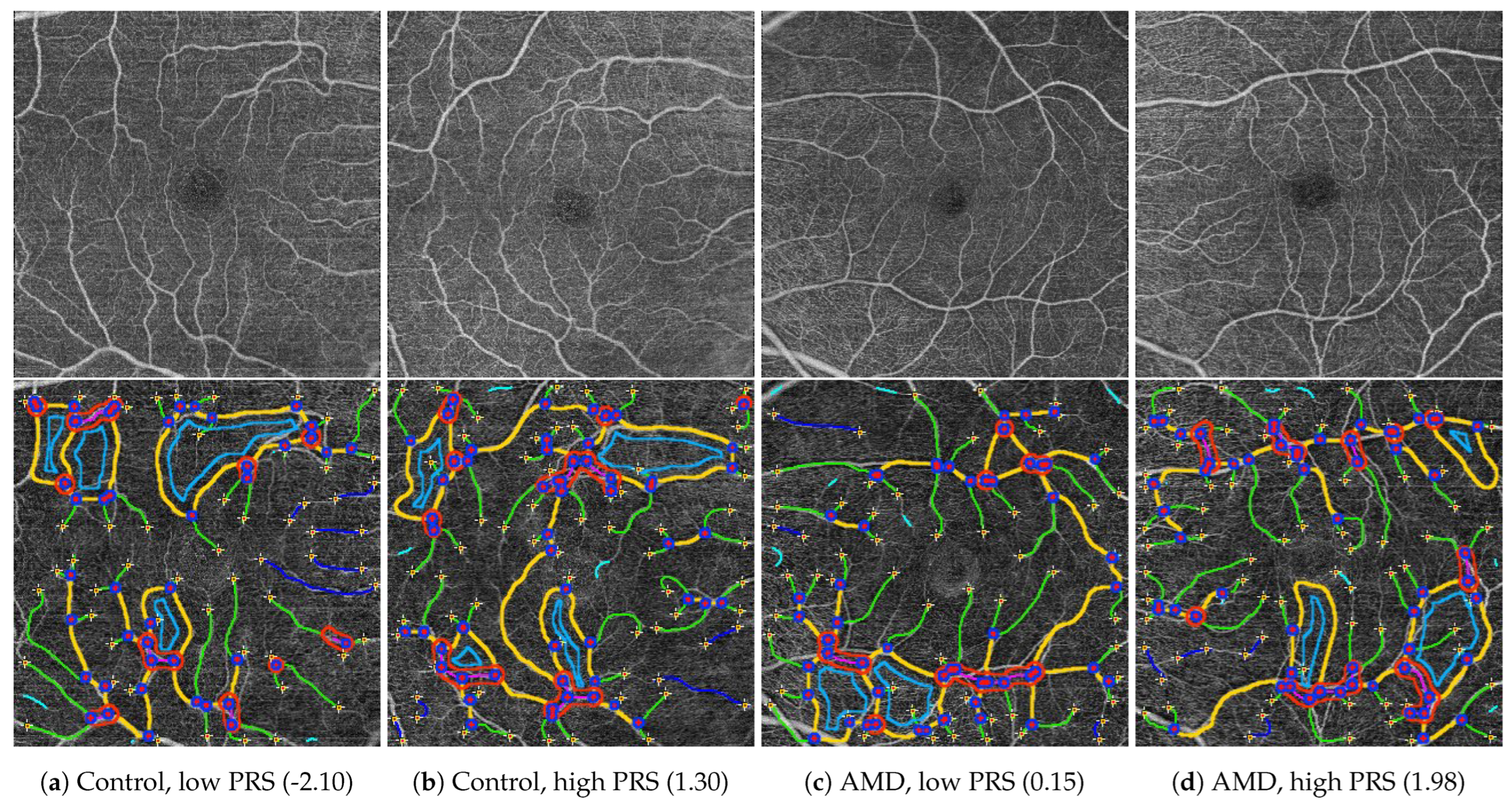 Diagnostics 14 00770 g004