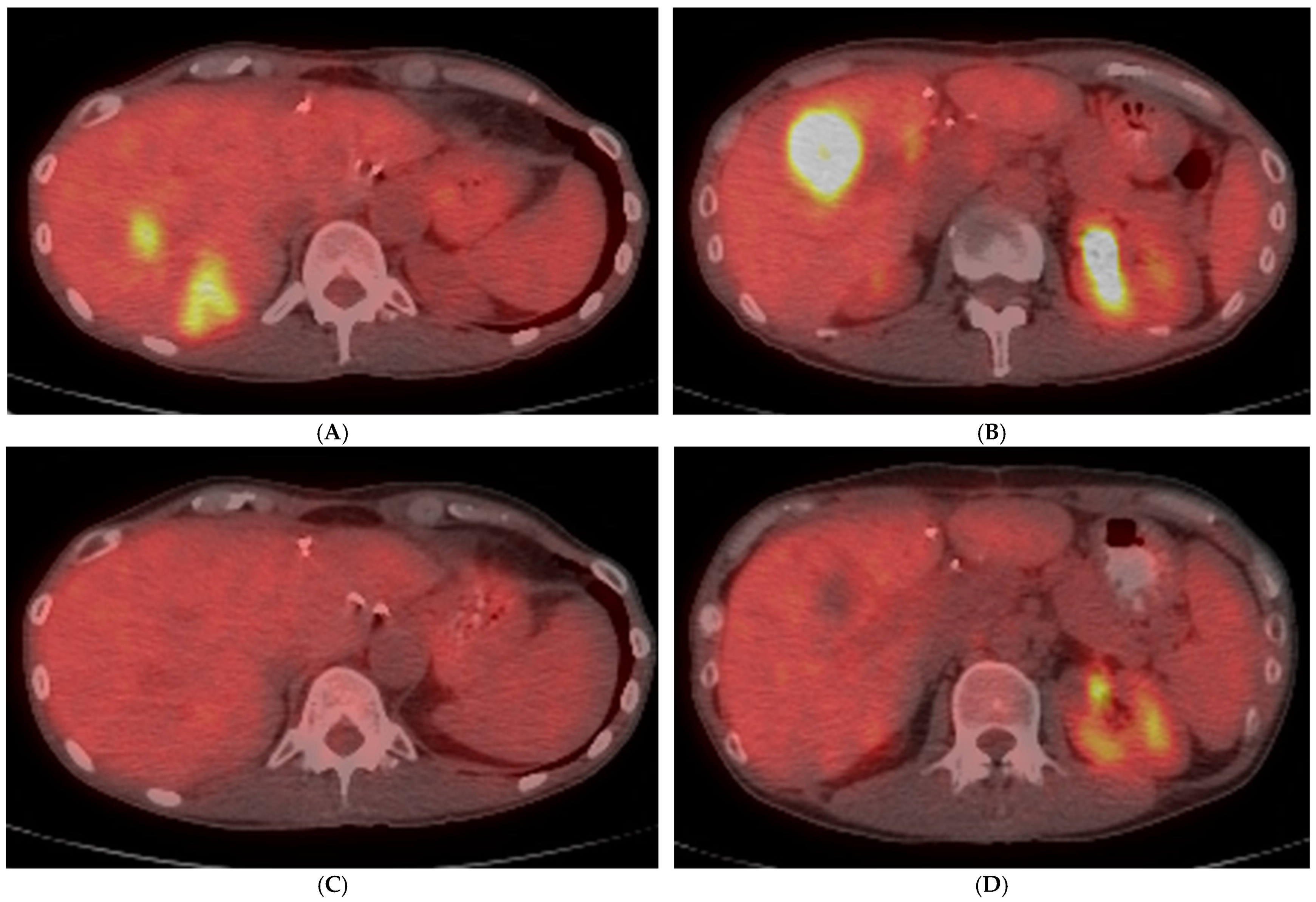 Diagnostics 14 00772 g004 Diagnostics 14 00772 g004