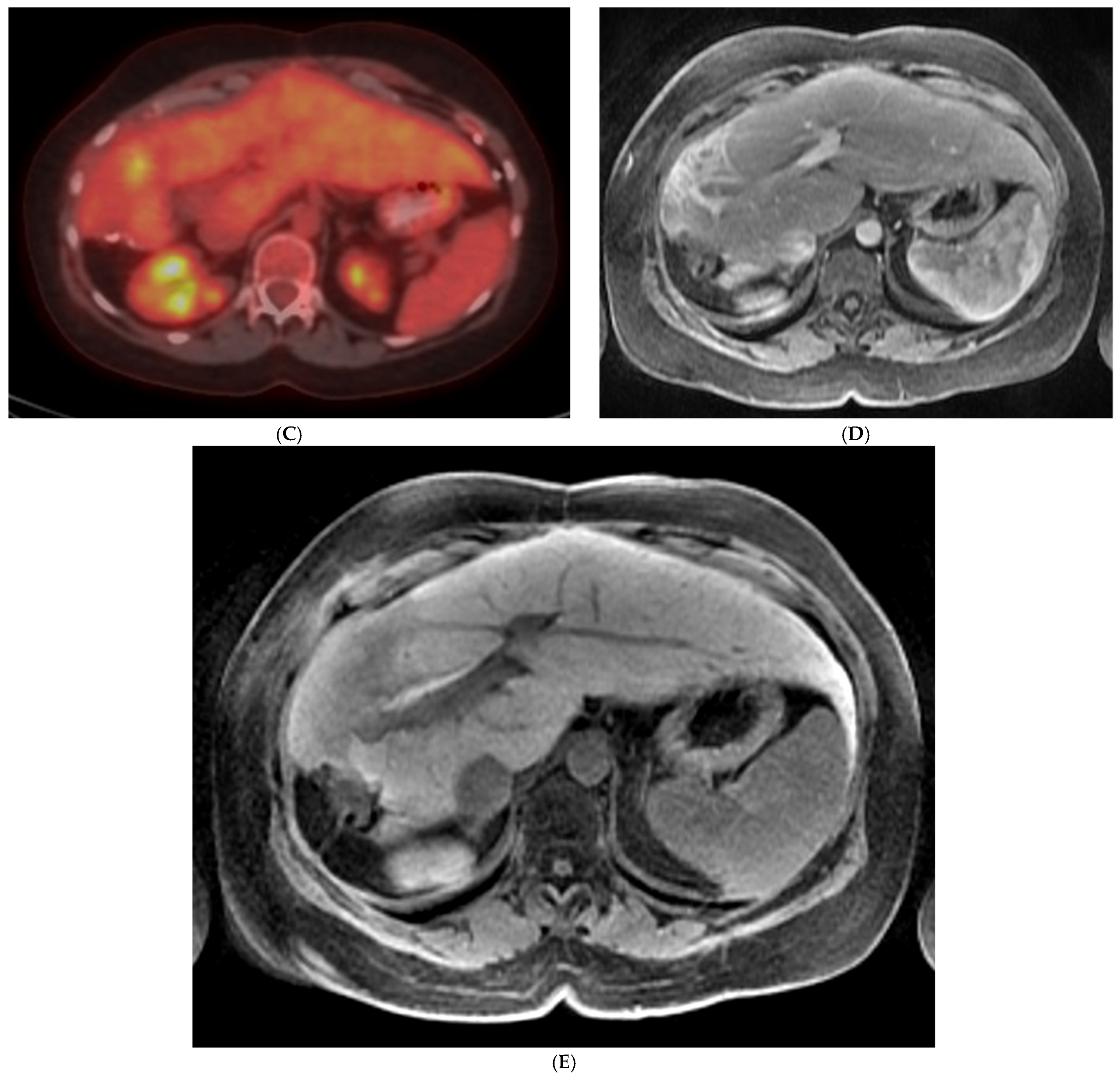 Diagnostics 14 00772 g005b Diagnostics 14 00772 g005b