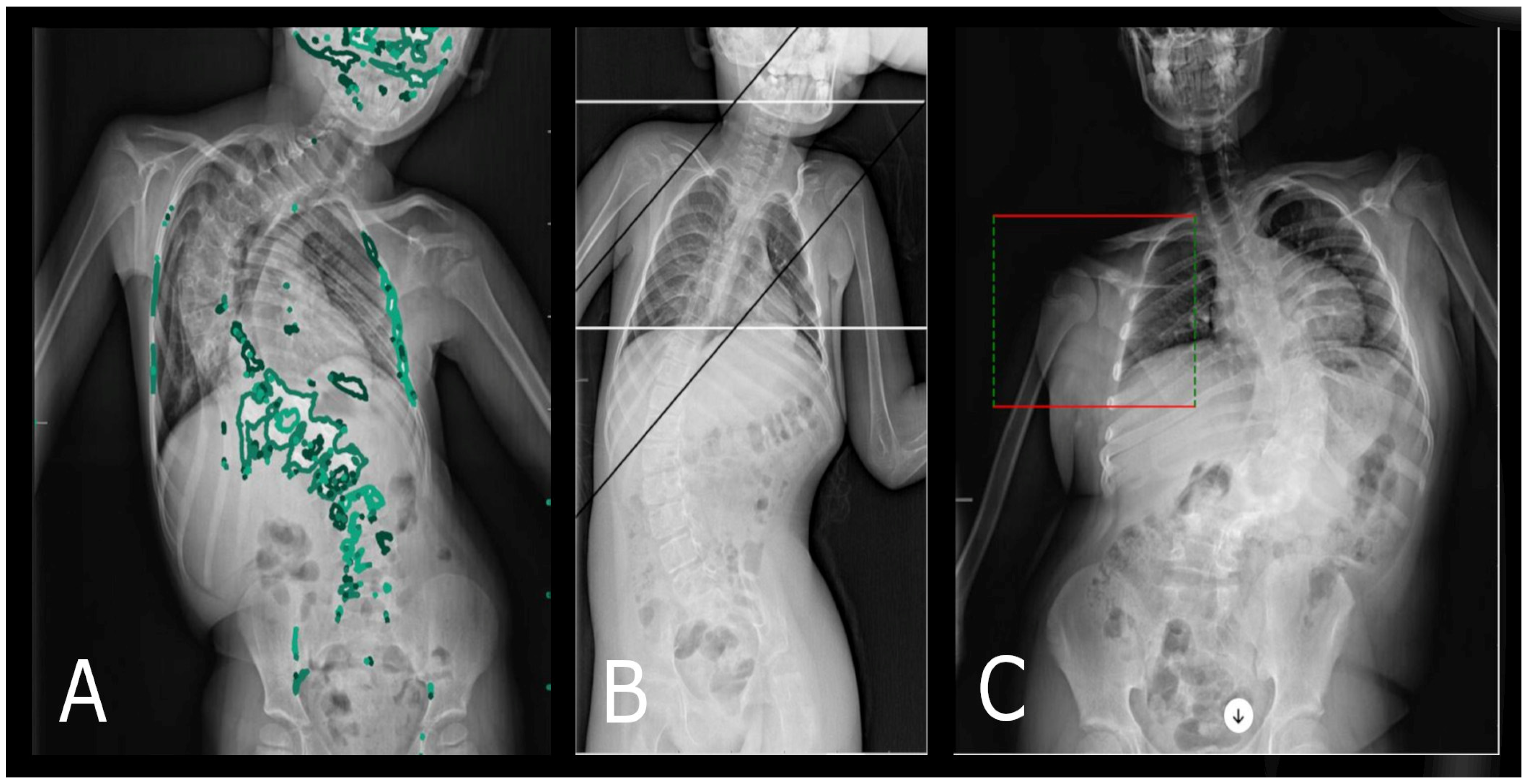 Diagnostics 14 00773 g004