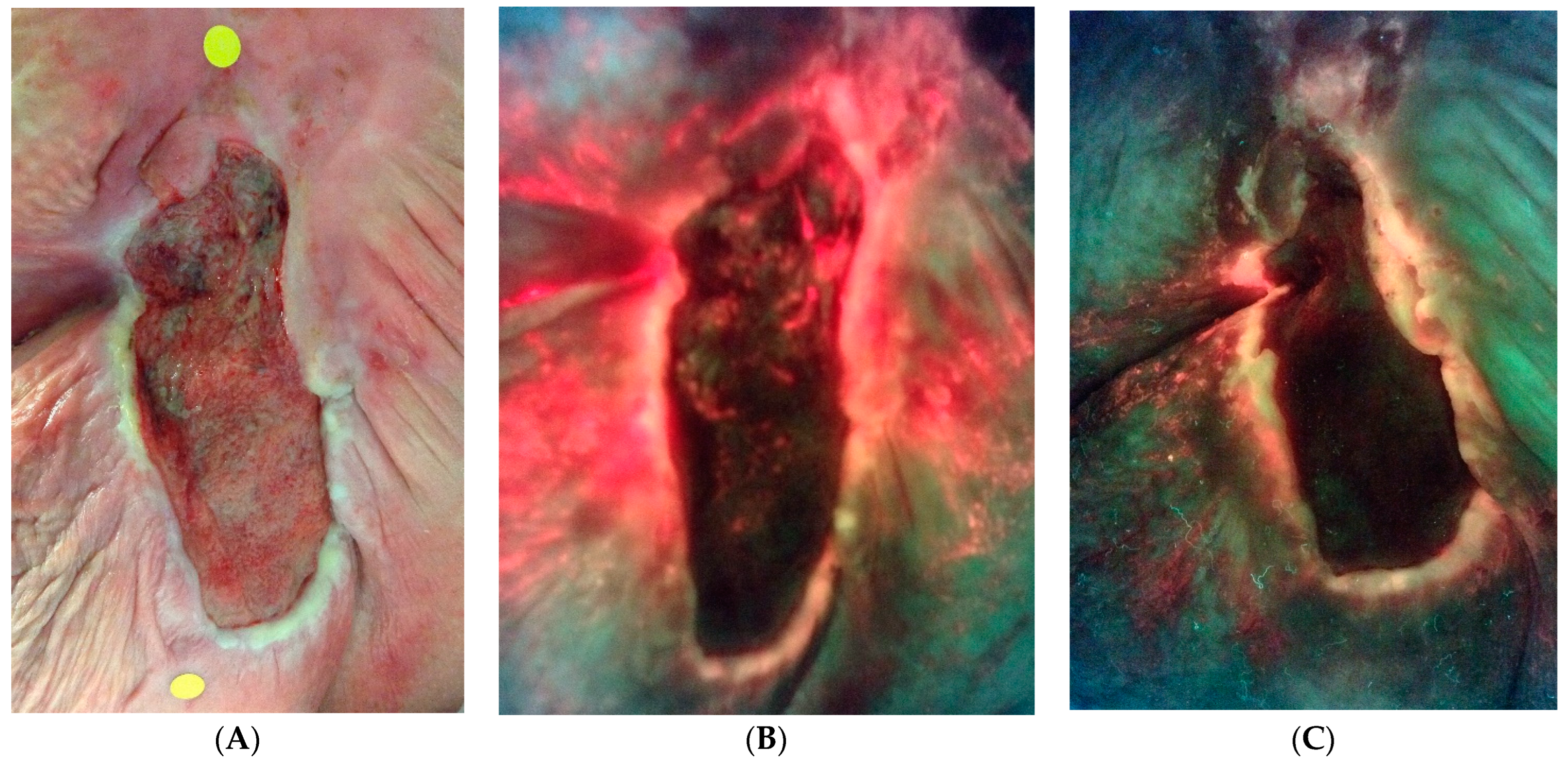 Diagnostics 14 00774 g005