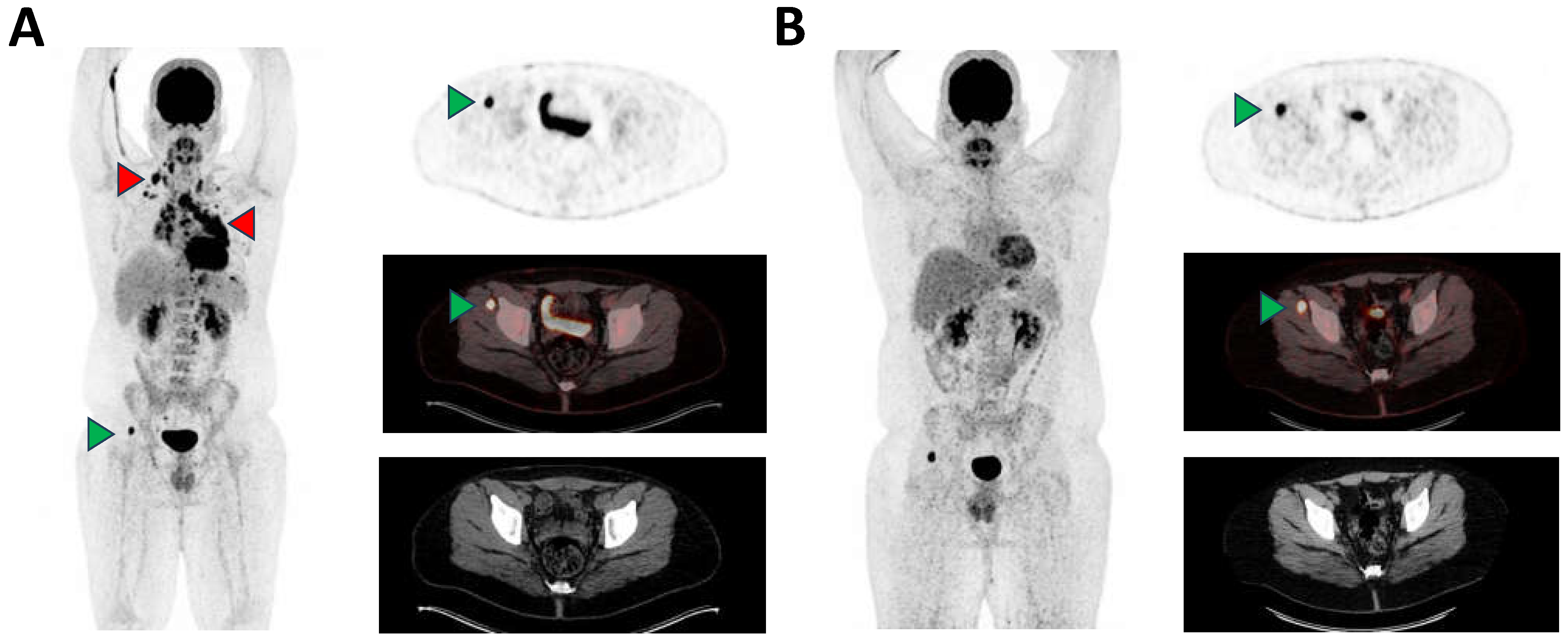 Diagnostics 14 00783 g001