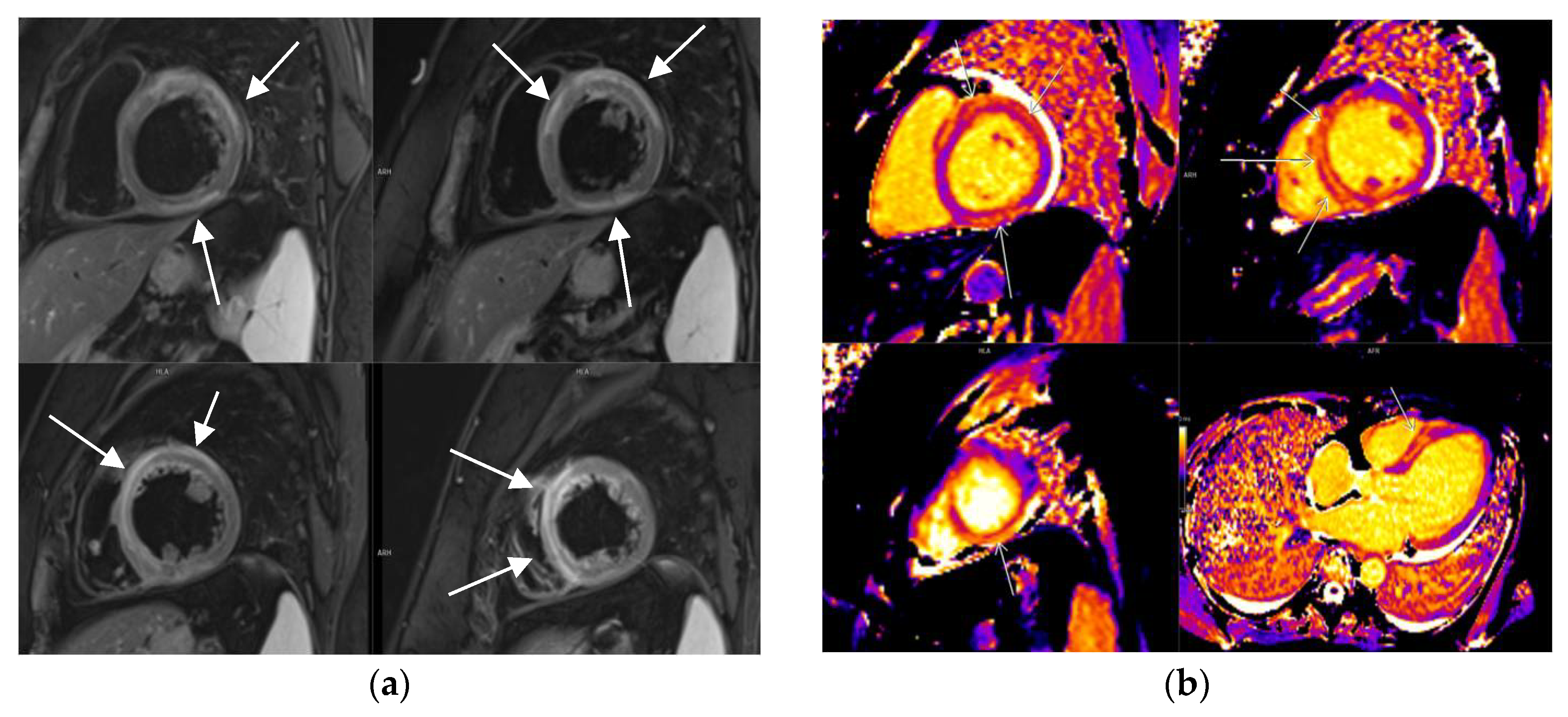 Diagnostics 14 00790 g001a
