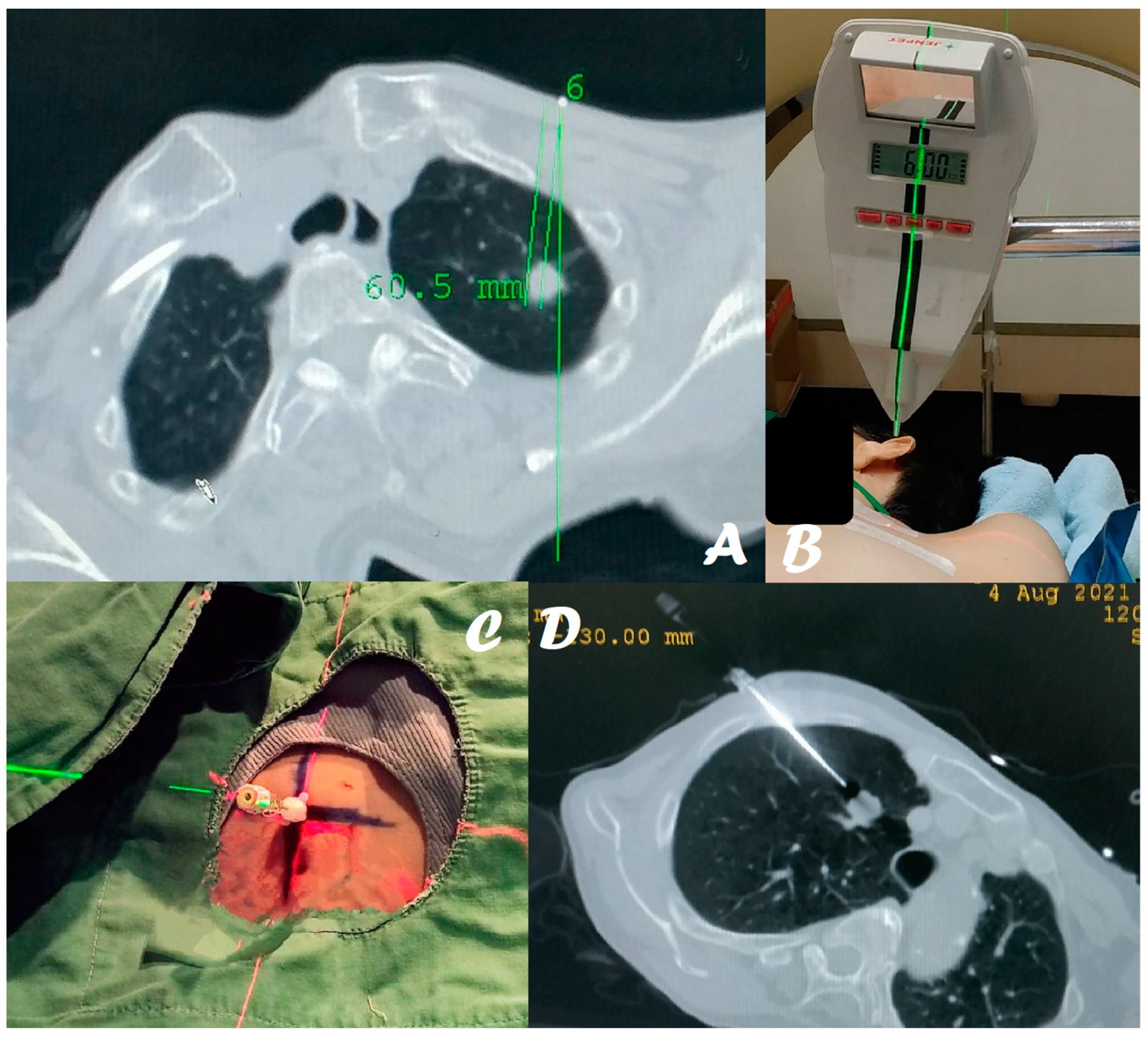 Diagnostics 14 00796 g001