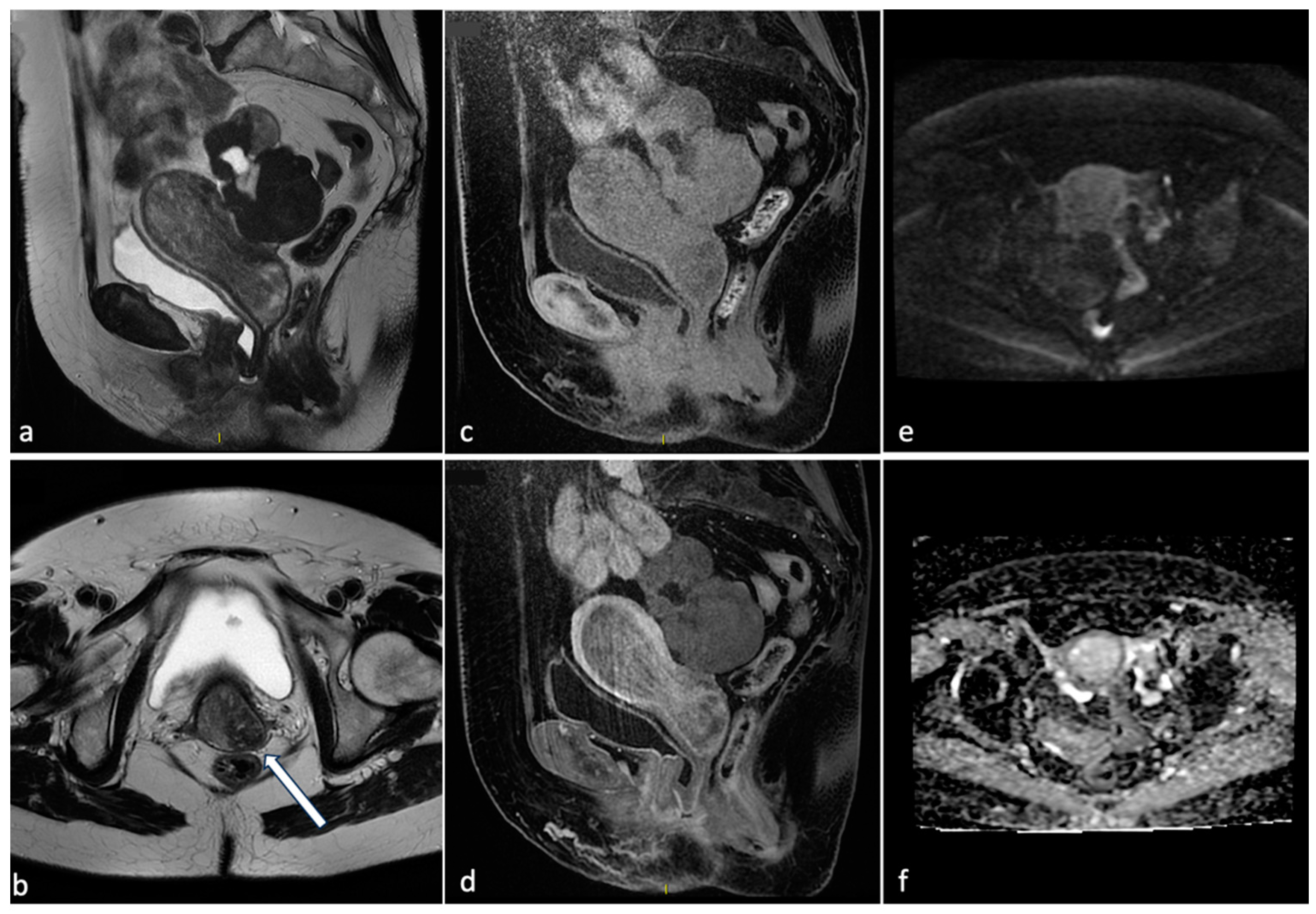 Diagnostics 14 00798 g001