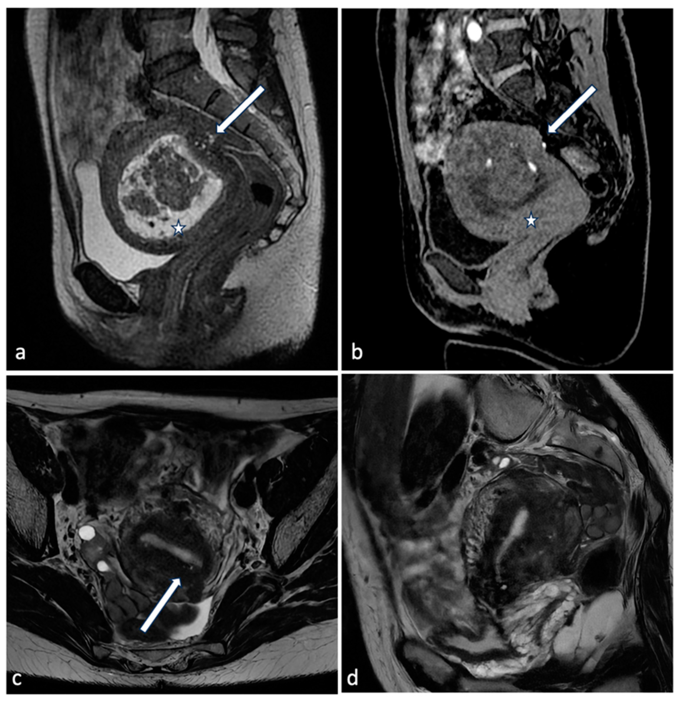 Diagnostics 14 00798 g002