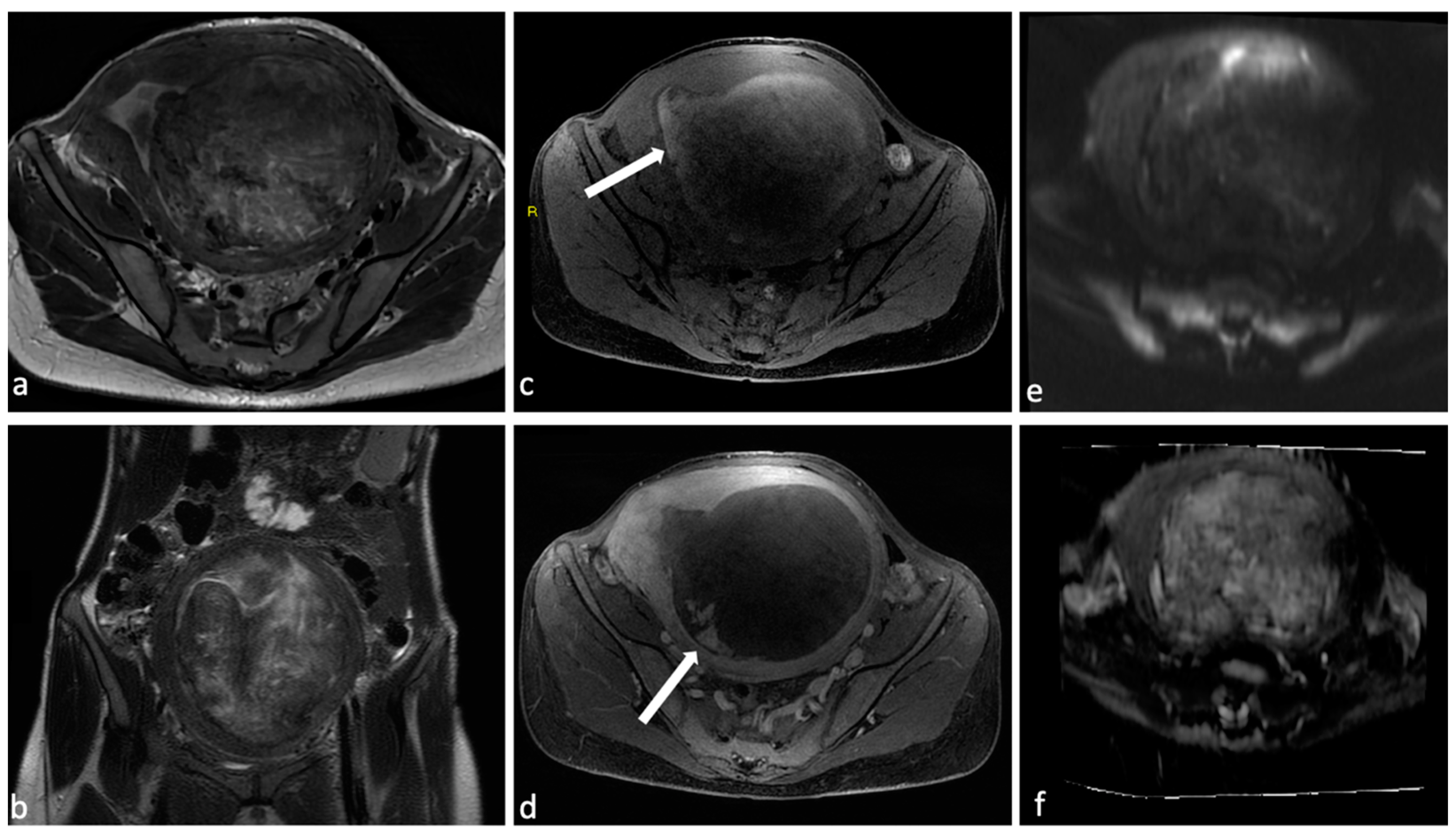 Diagnostics 14 00798 g003