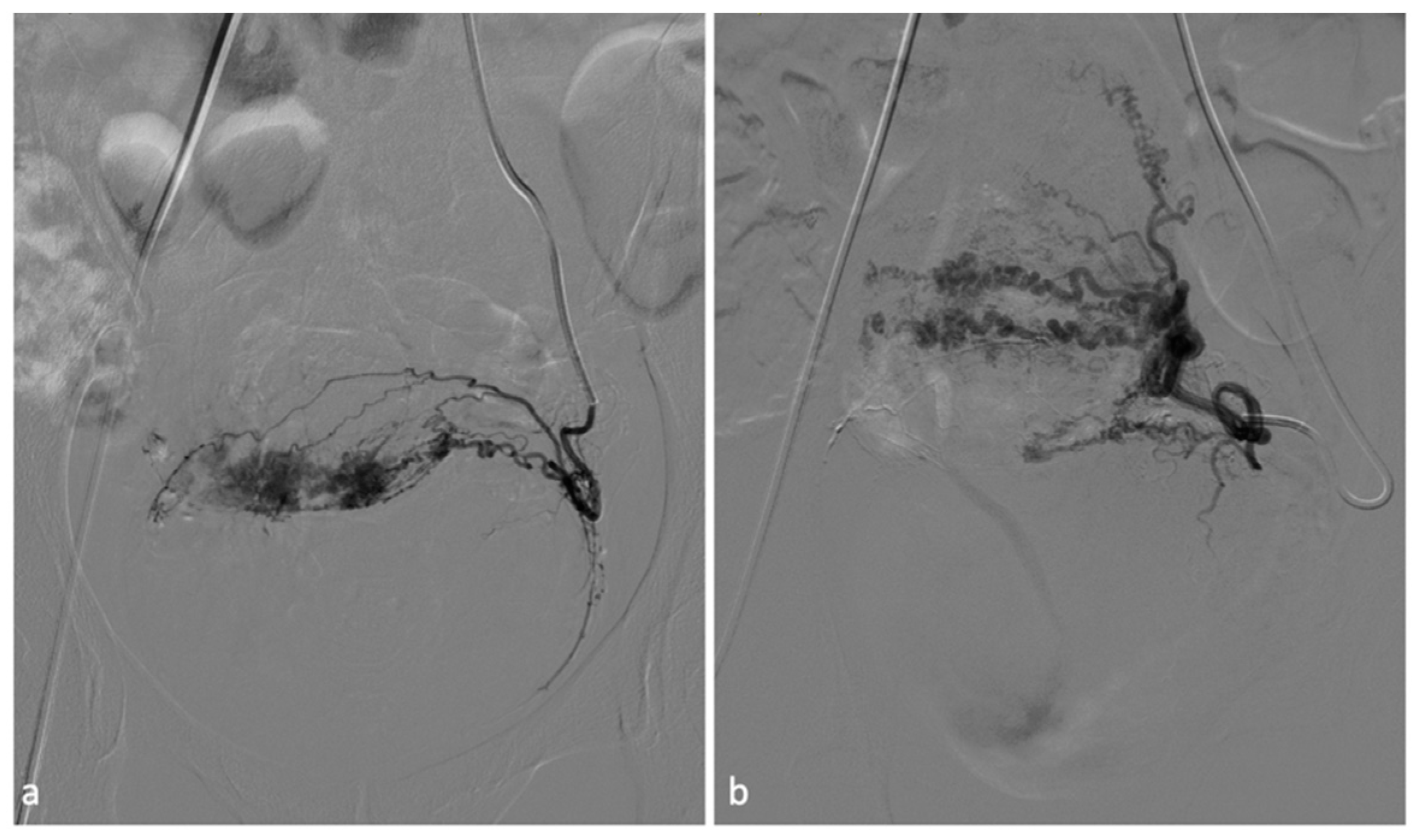 Diagnostics 14 00798 g006