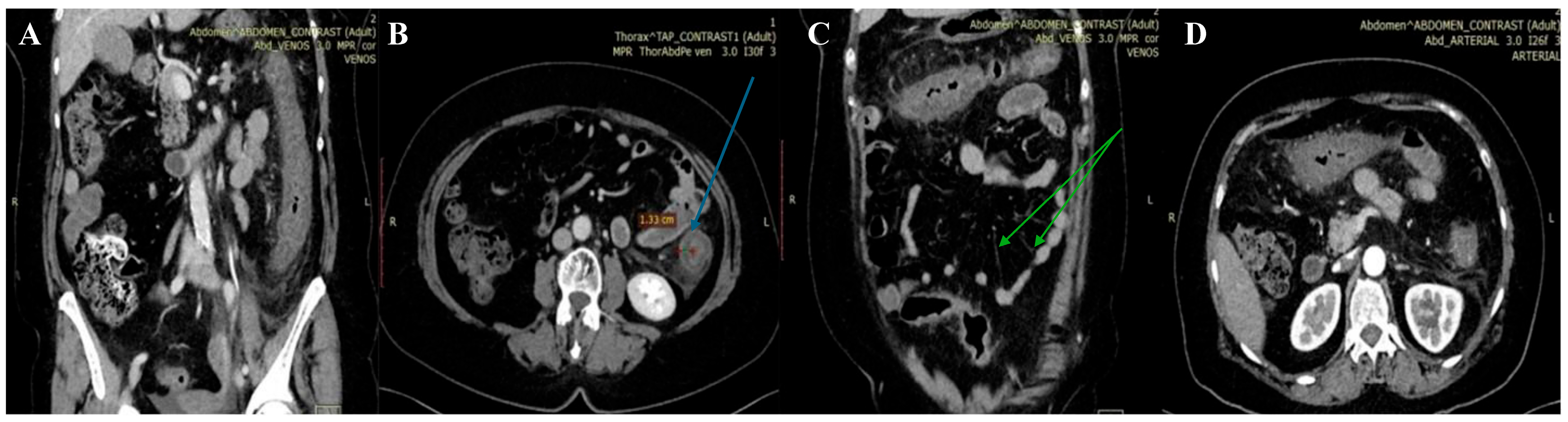Diagnostics 14 00801 g001 Diagnostics 14 00801 g001
