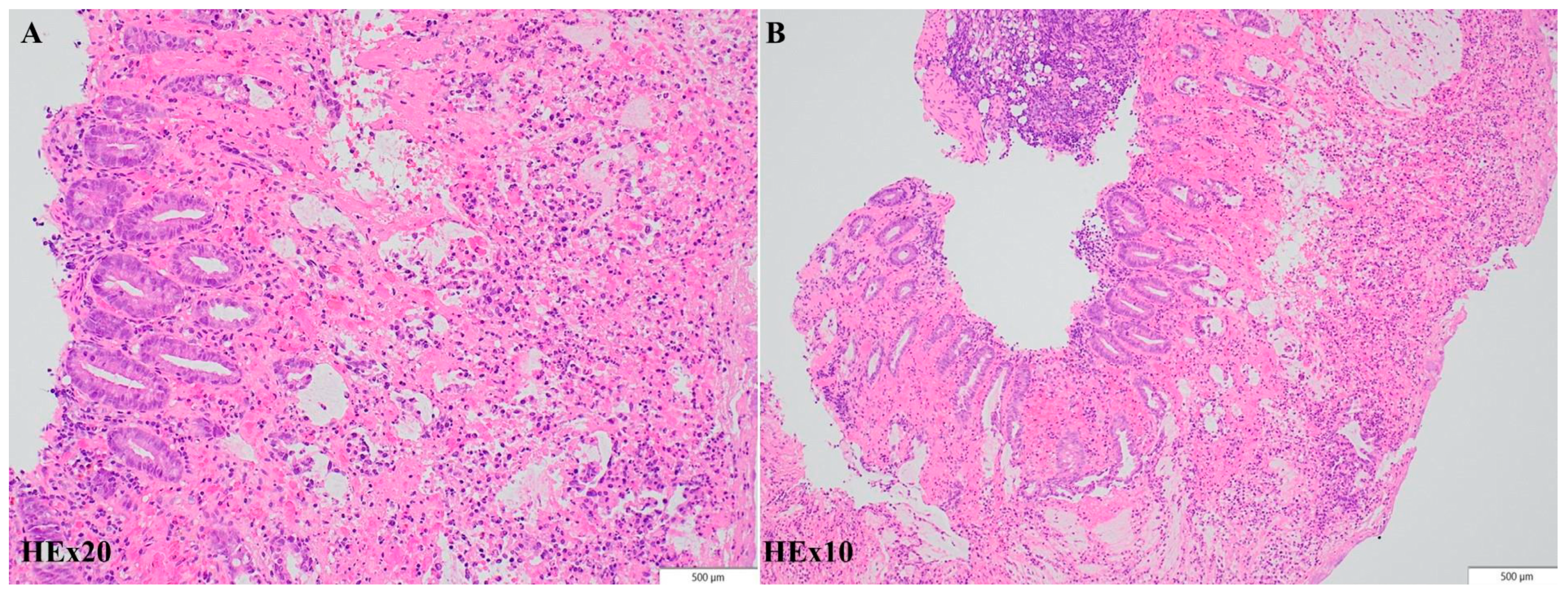 Diagnostics 14 00801 g004 Diagnostics 14 00801 g004