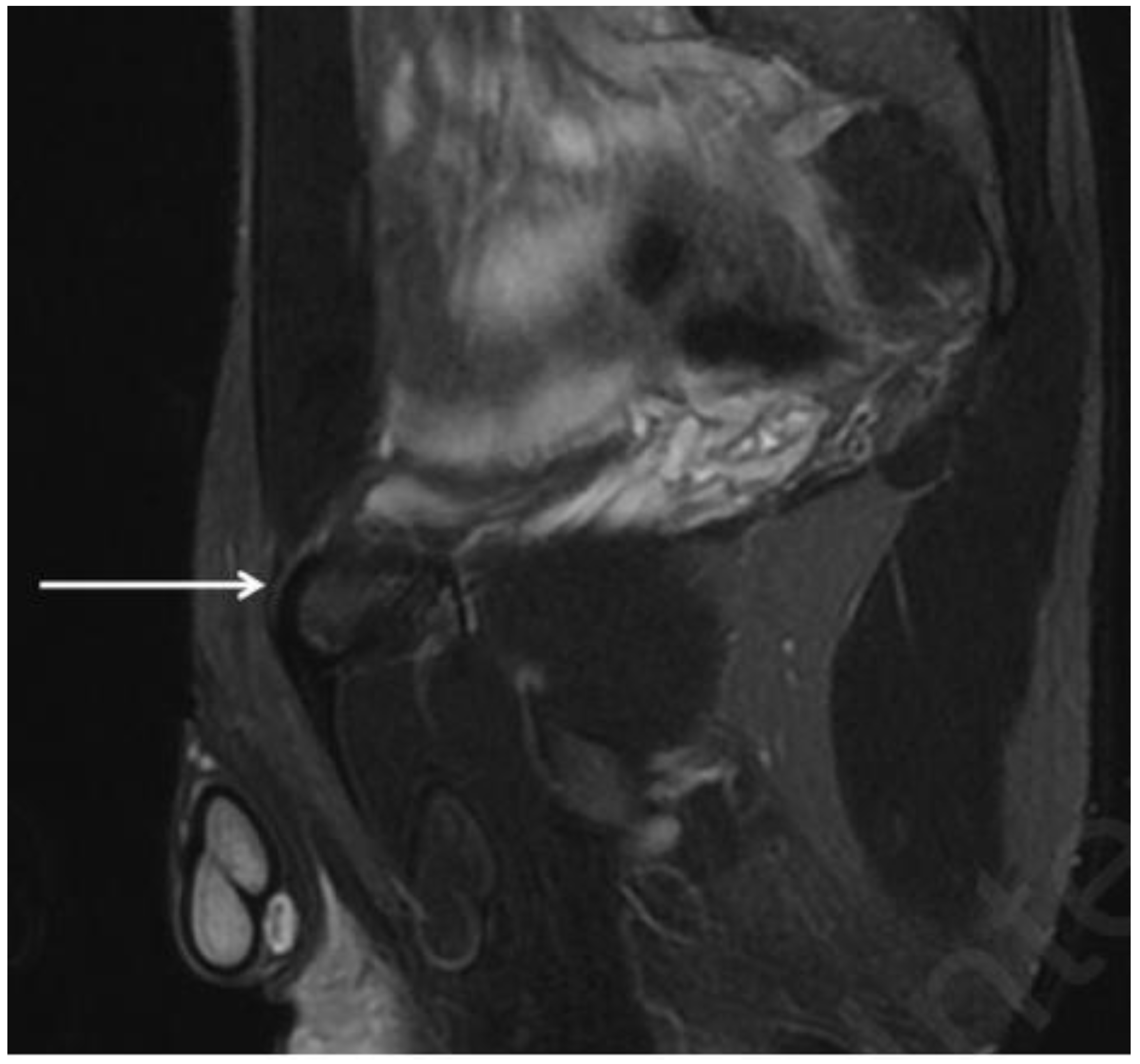 Diagnostics 14 00814 g011