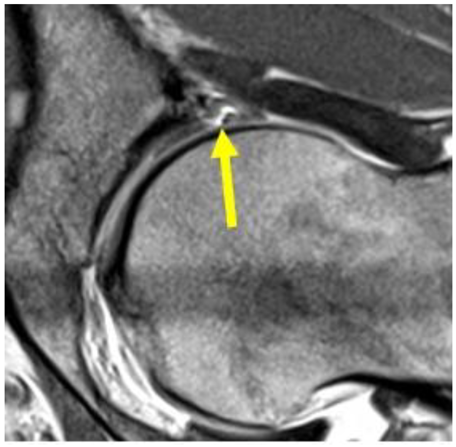 Diagnostics 14 00814 g013