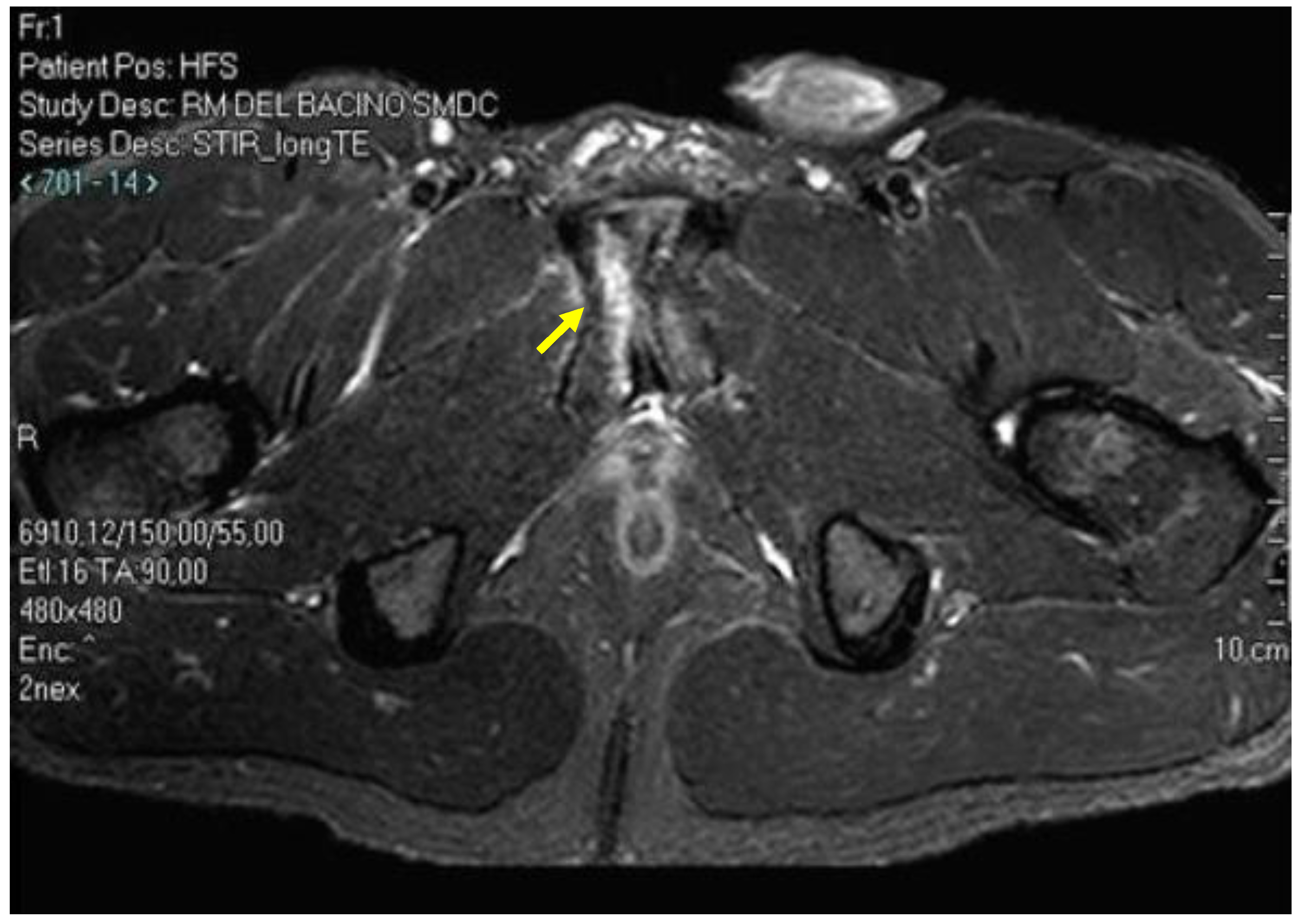 Diagnostics 14 00814 g016