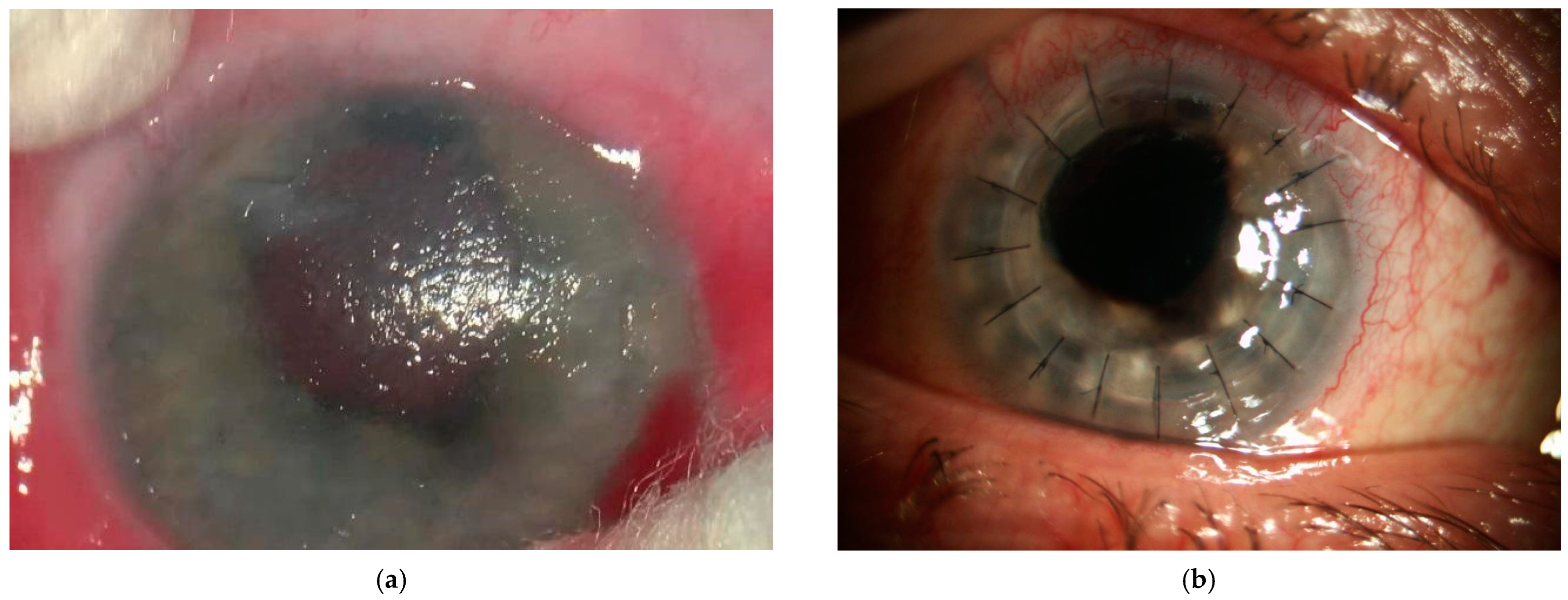 Diagnostics 14 00837 g001 Diagnostics 14 00837 g001