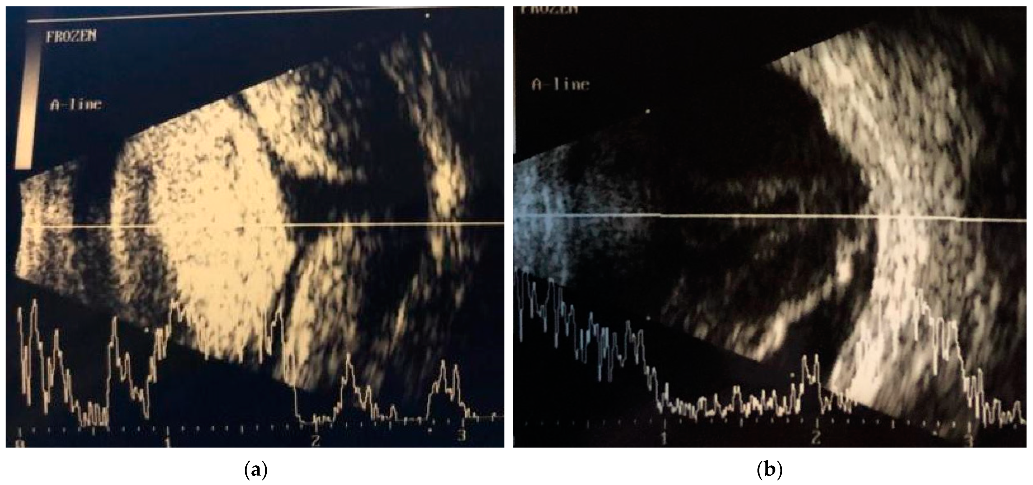 Diagnostics 14 00837 g002 Diagnostics 14 00837 g002