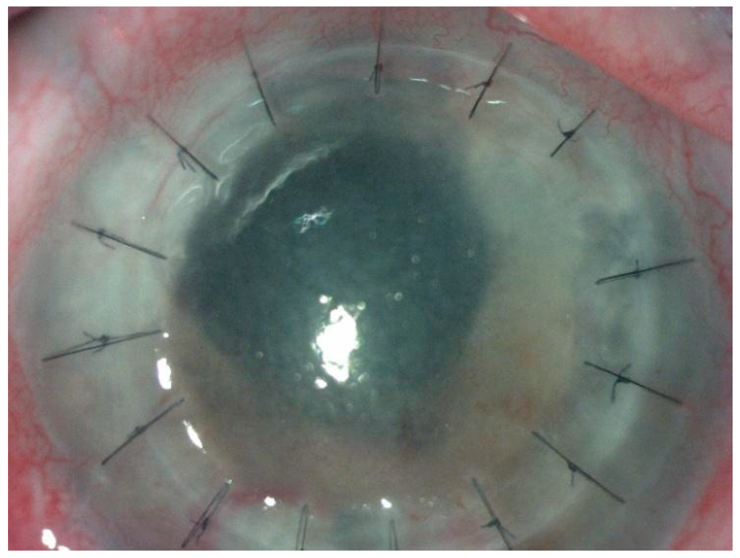 Diagnostics 14 00837 g003 Diagnostics 14 00837 g003