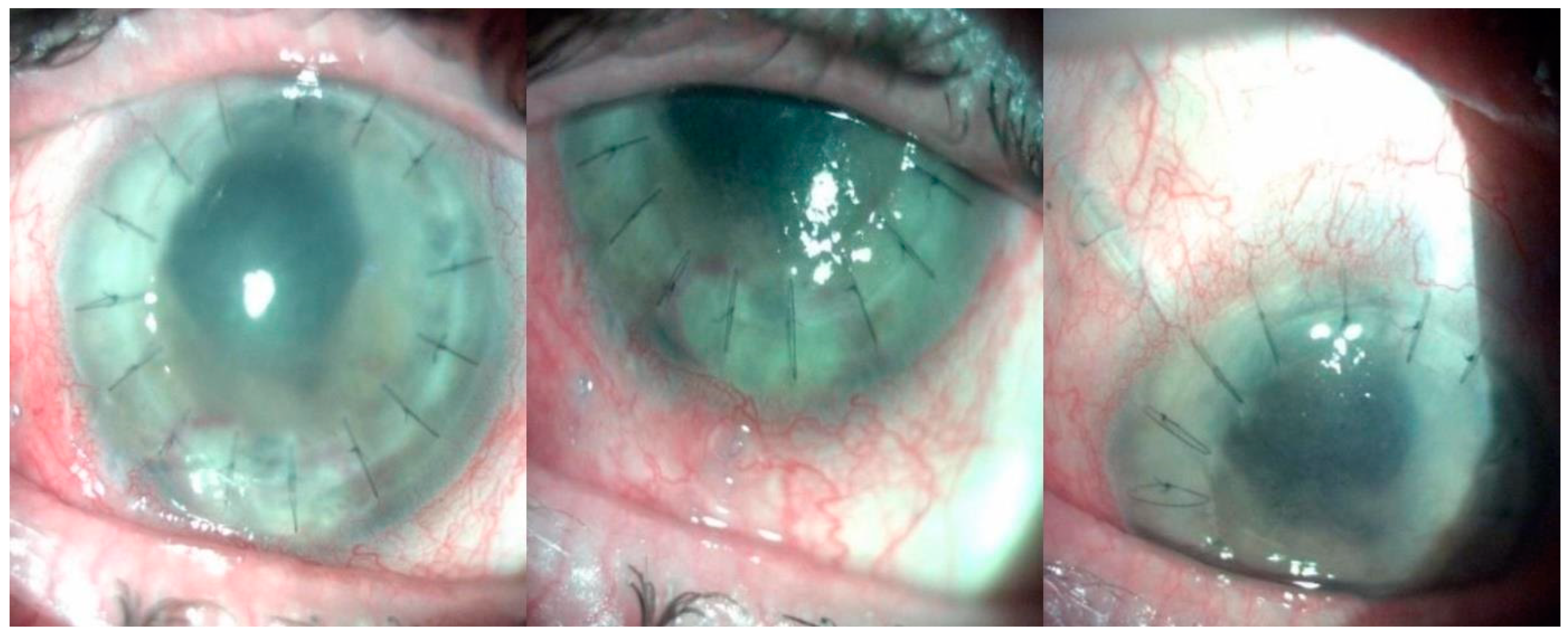 Diagnostics 14 00837 g004 Diagnostics 14 00837 g004