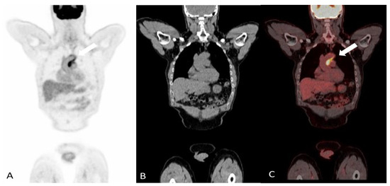 Multi-Modality Imaging in Vasculitis