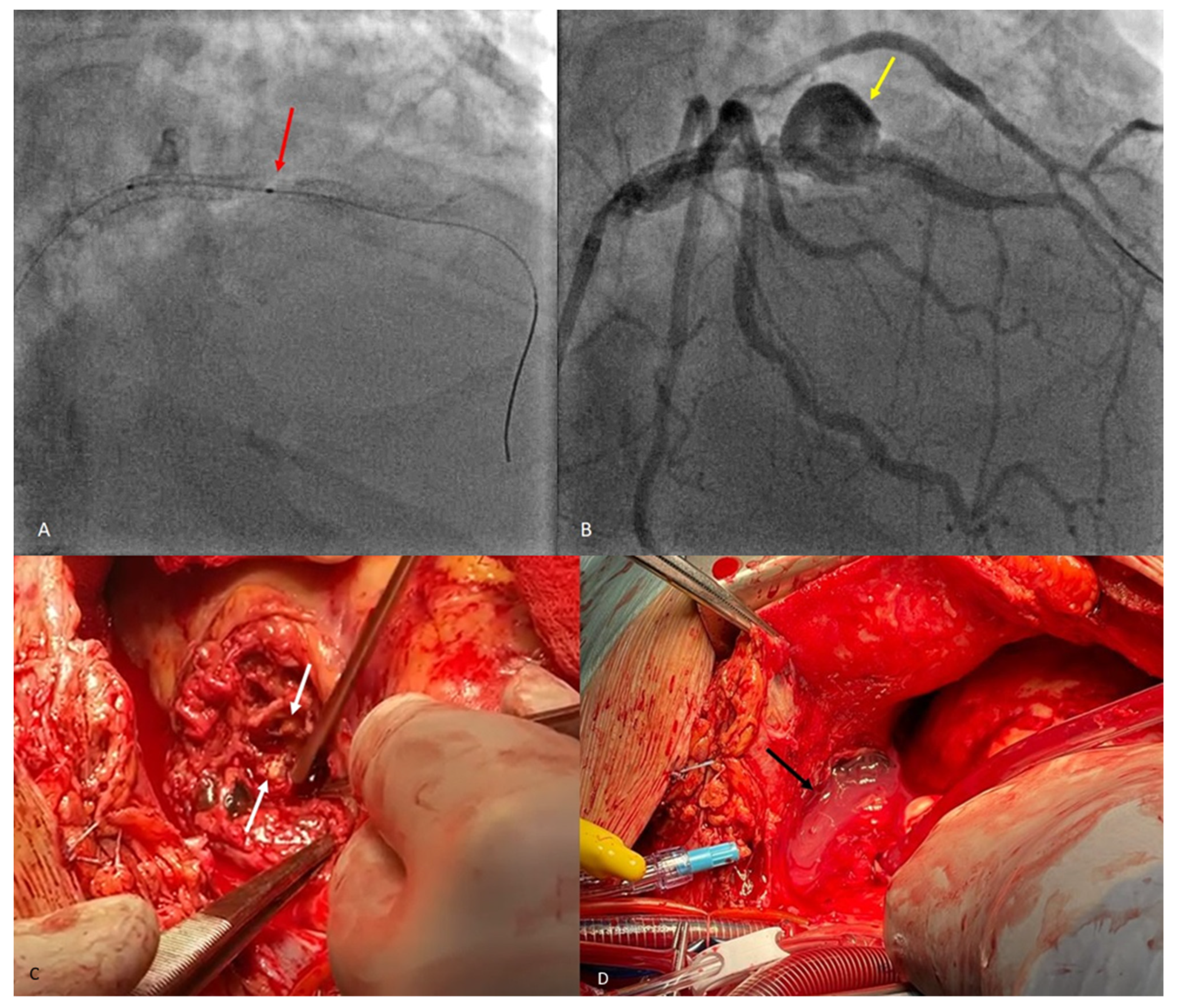 Diagnostics 14 00840 g003