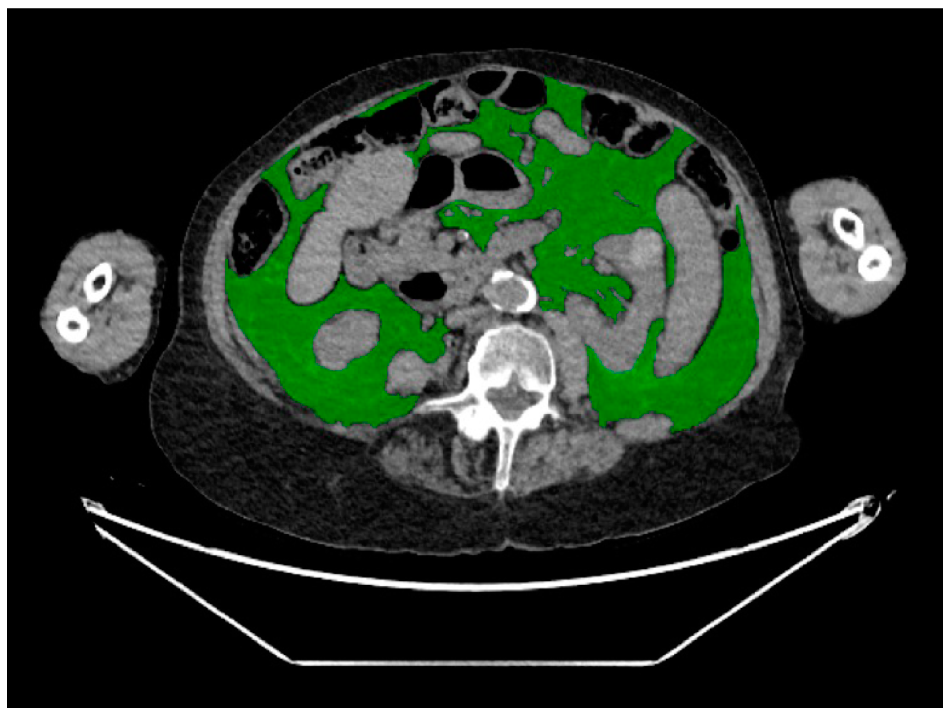 Diagnostics 14 00844 g002