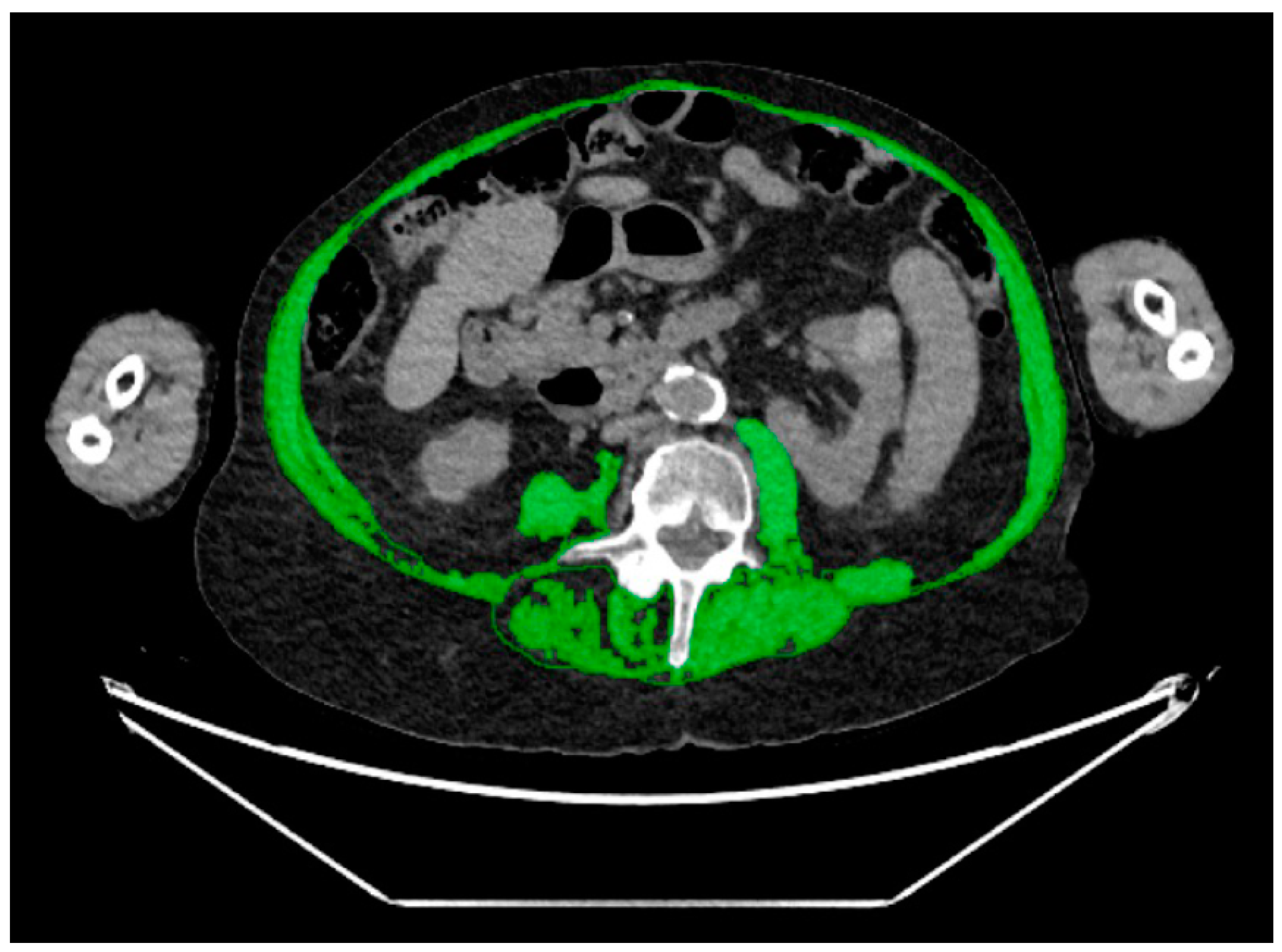 Diagnostics 14 00844 g003