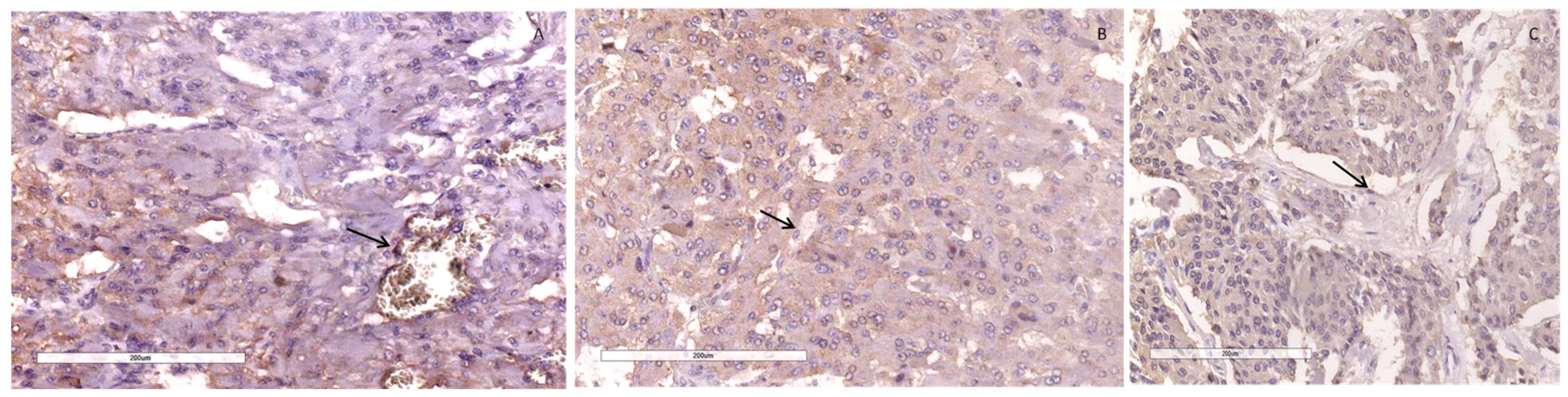 Diagnostics 14 00849 g006