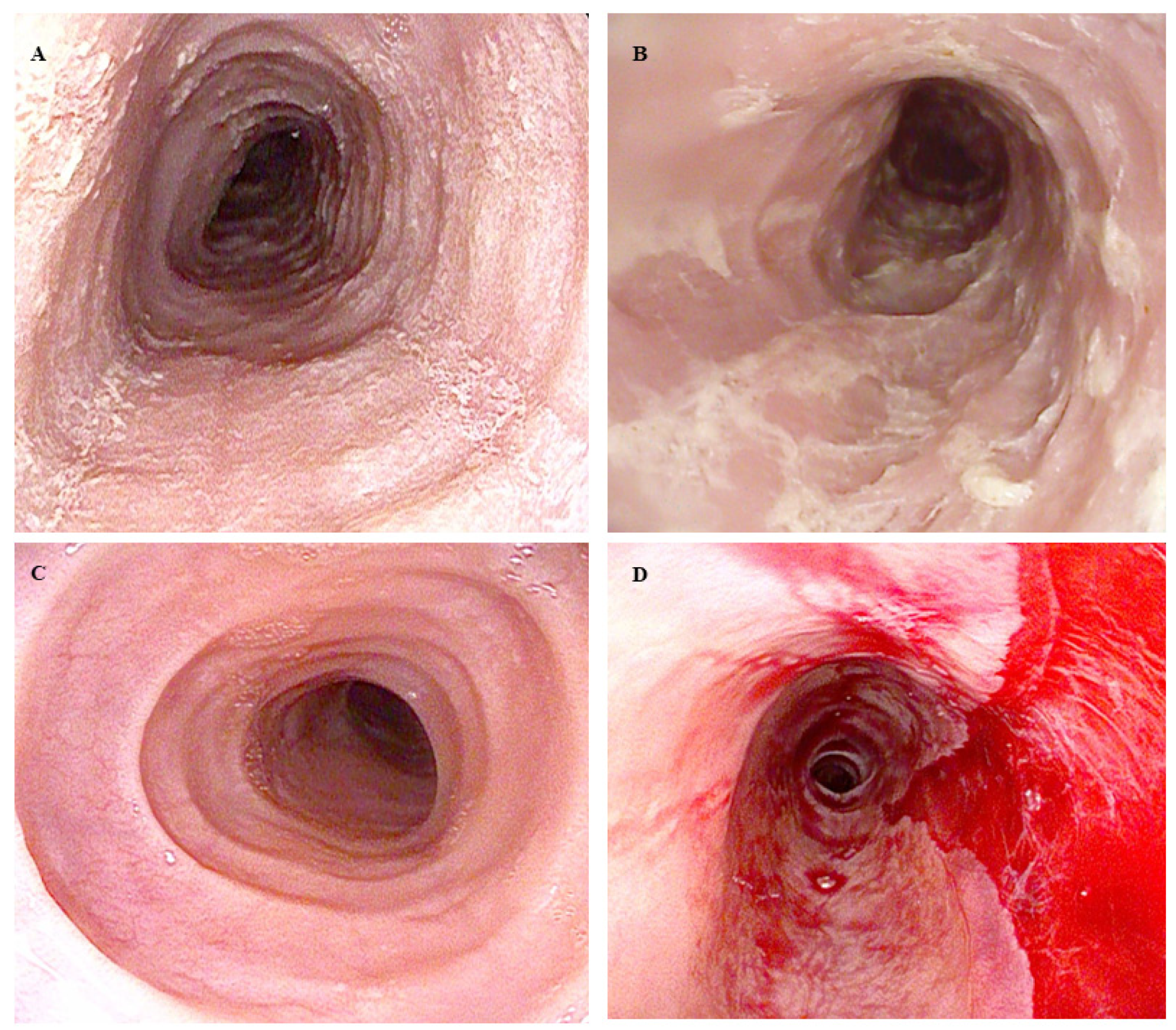 Diagnostics 14 00858 g002