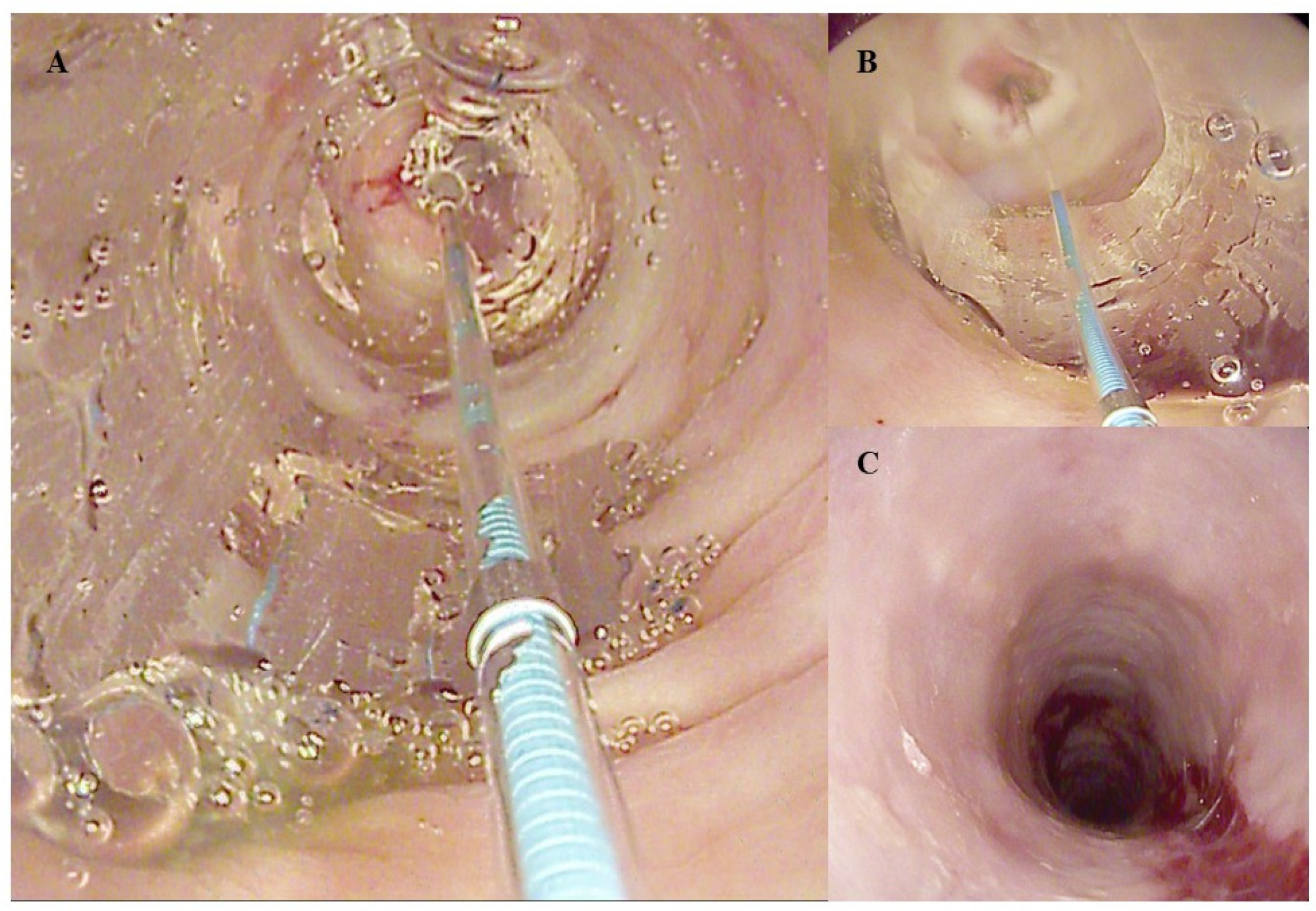 Diagnostics 14 00858 g003