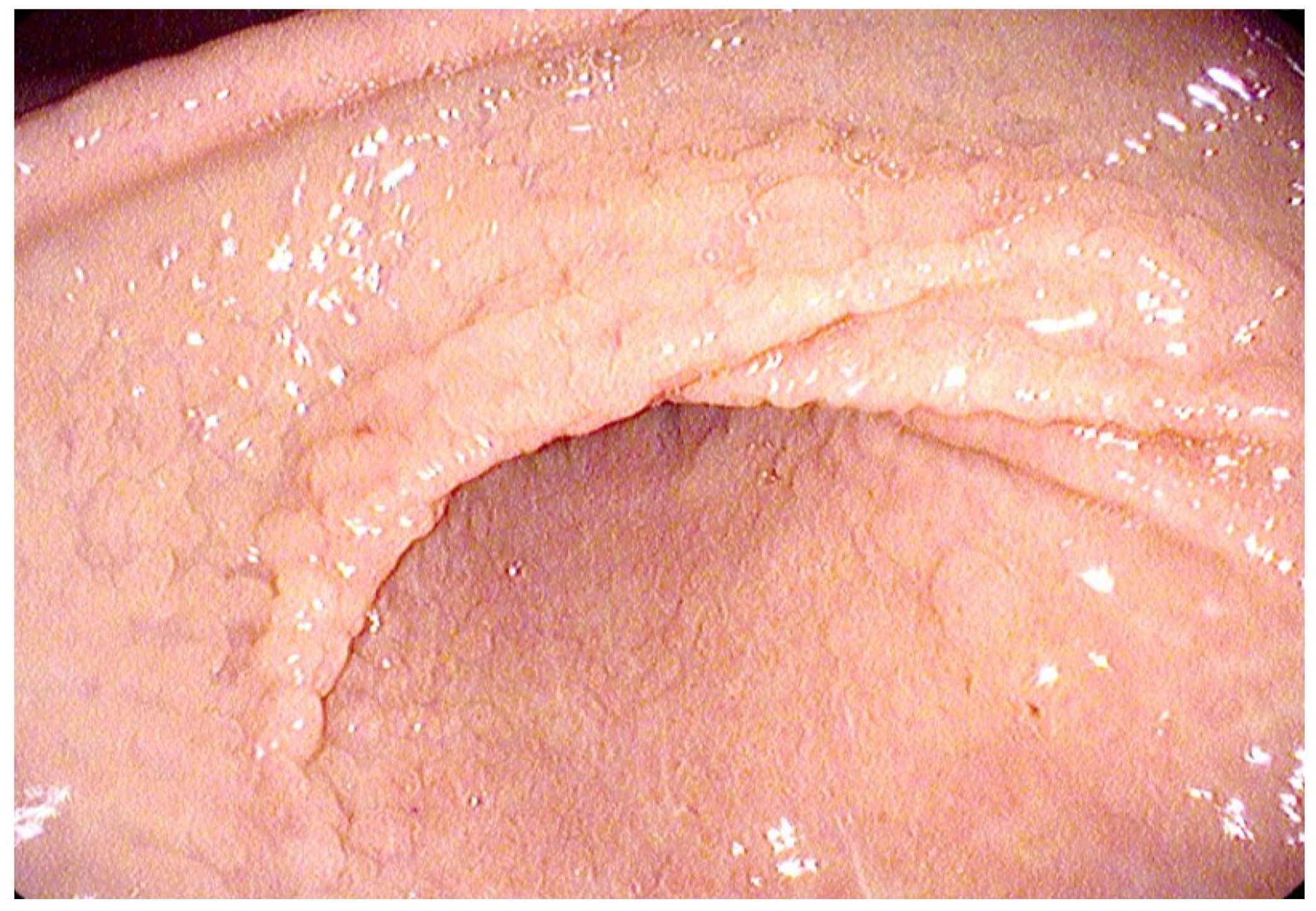 Diagnostics 14 00858 g005