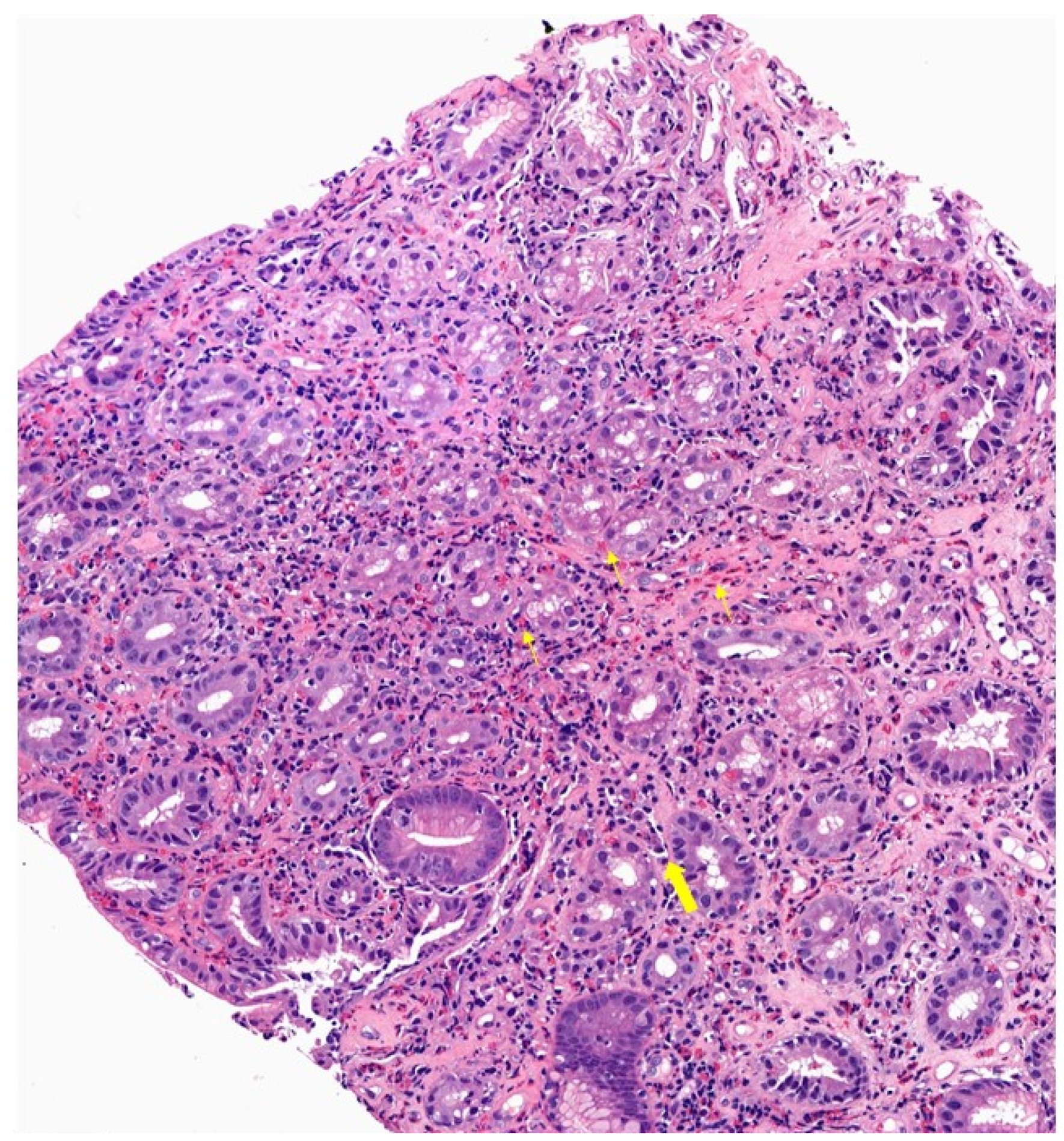 Diagnostics 14 00858 g006