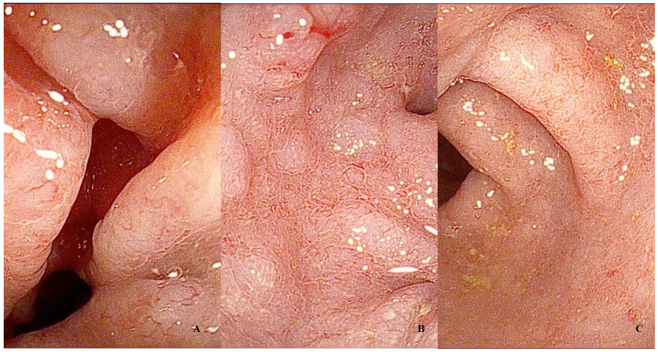 Diagnostics 14 00858 g007