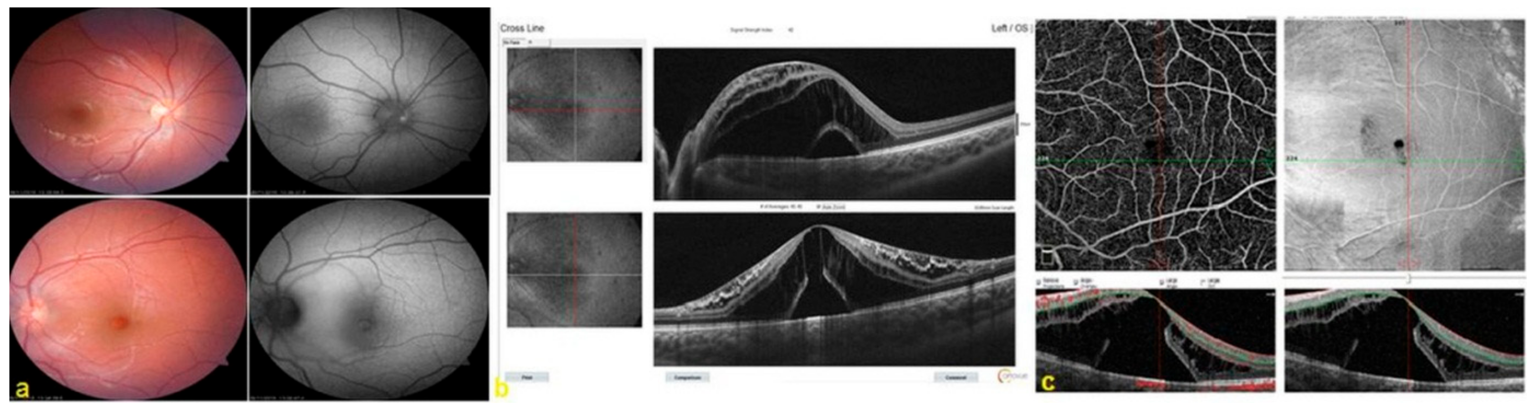 Diagnostics 14 00874 g001
