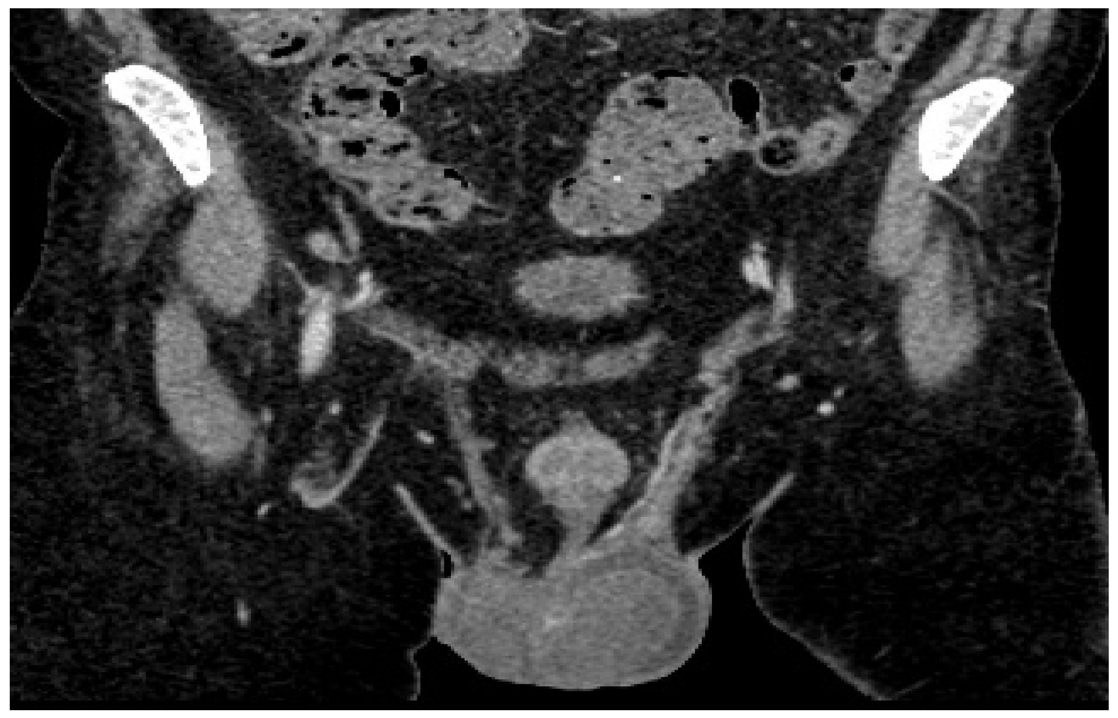 Diagnostics 14 00875 g004
