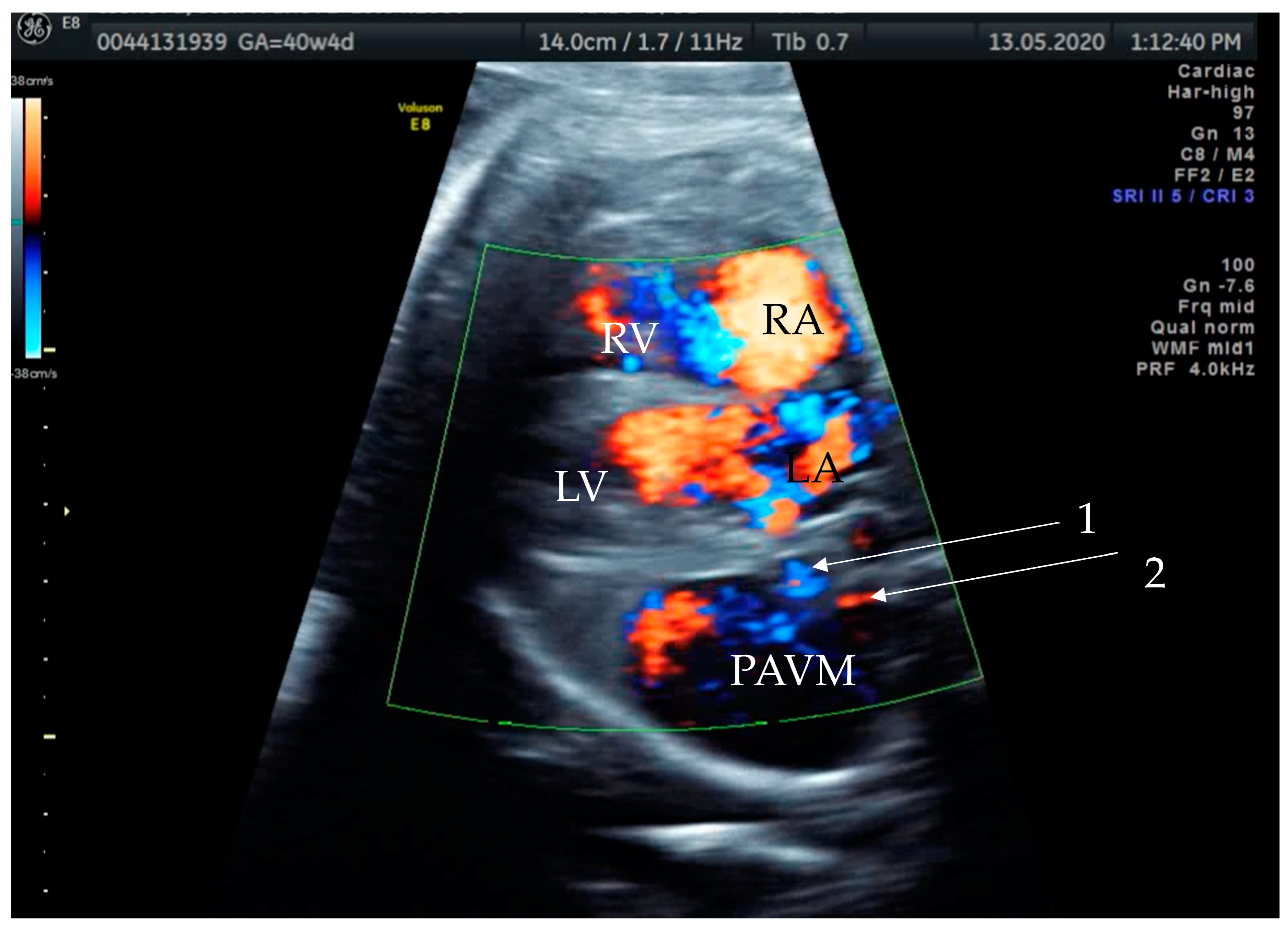 Diagnostics 14 00876 g002