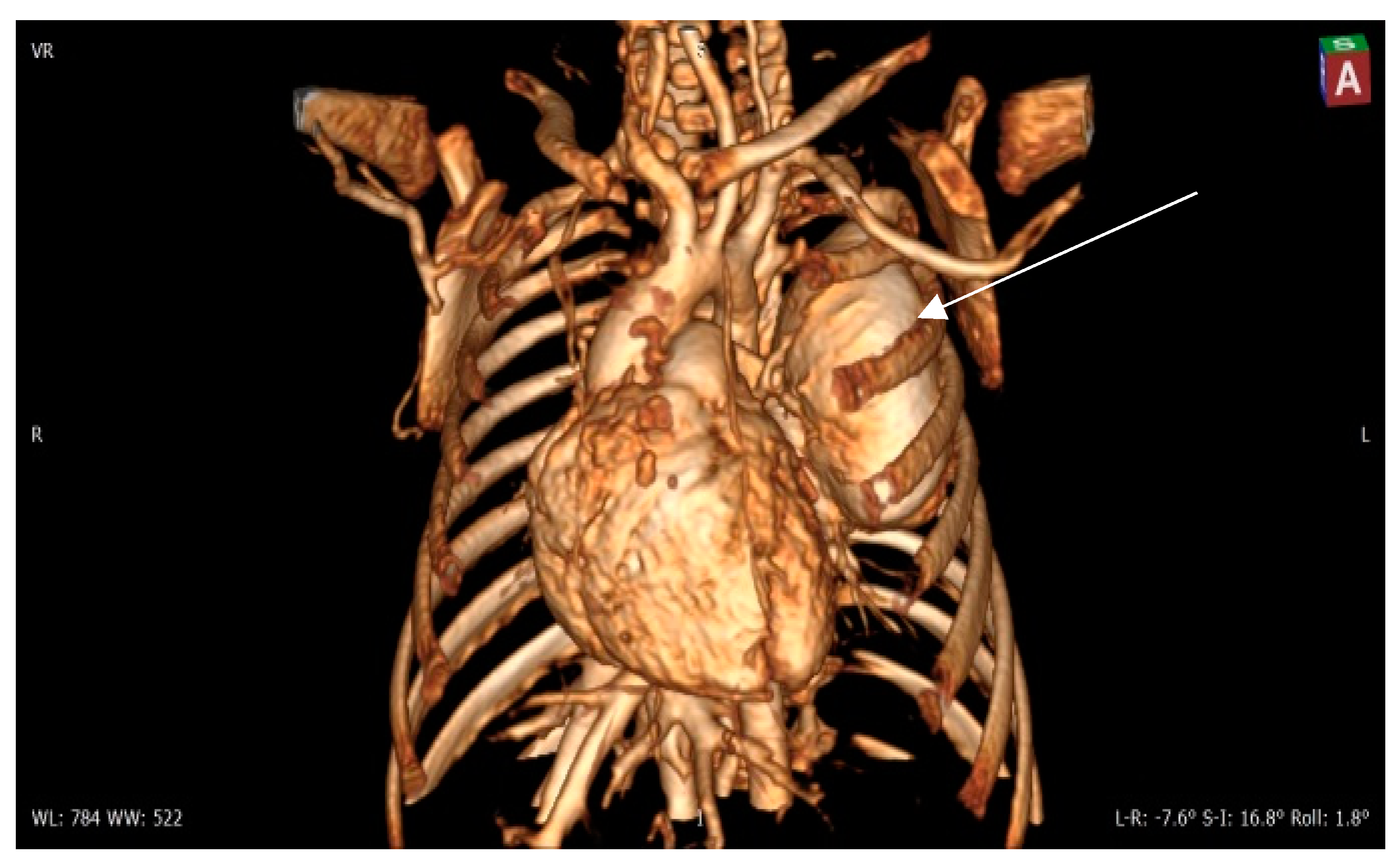 Diagnostics 14 00876 g004