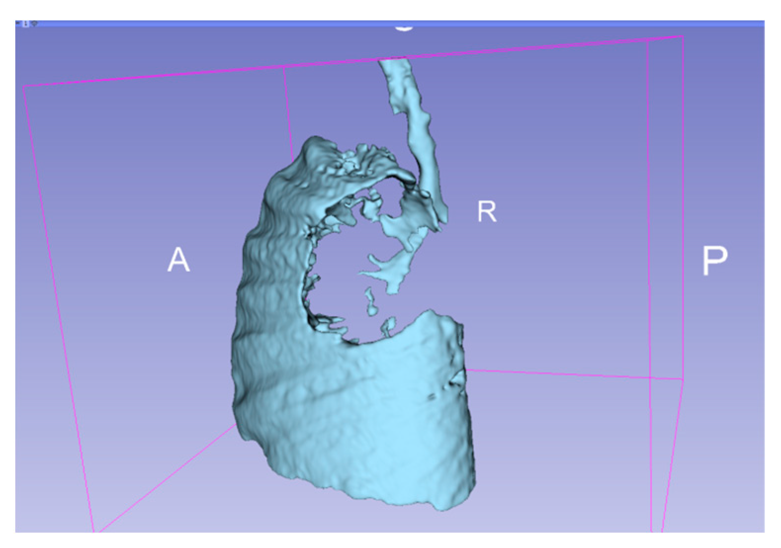 Diagnostics 14 00876 g005
