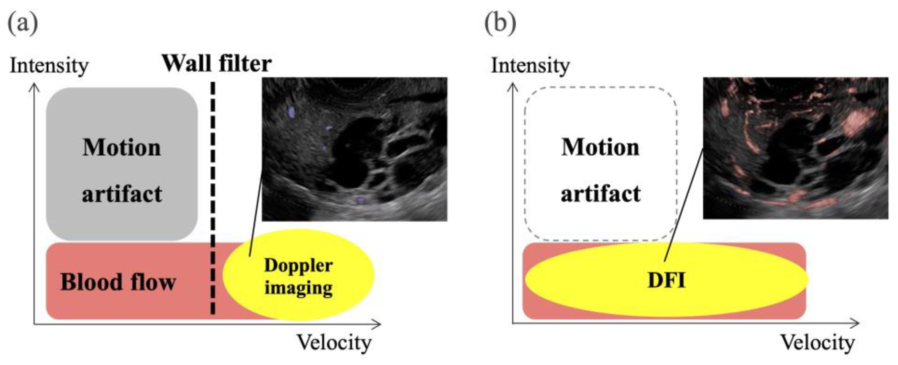 Diagnostics 14 00882 g001