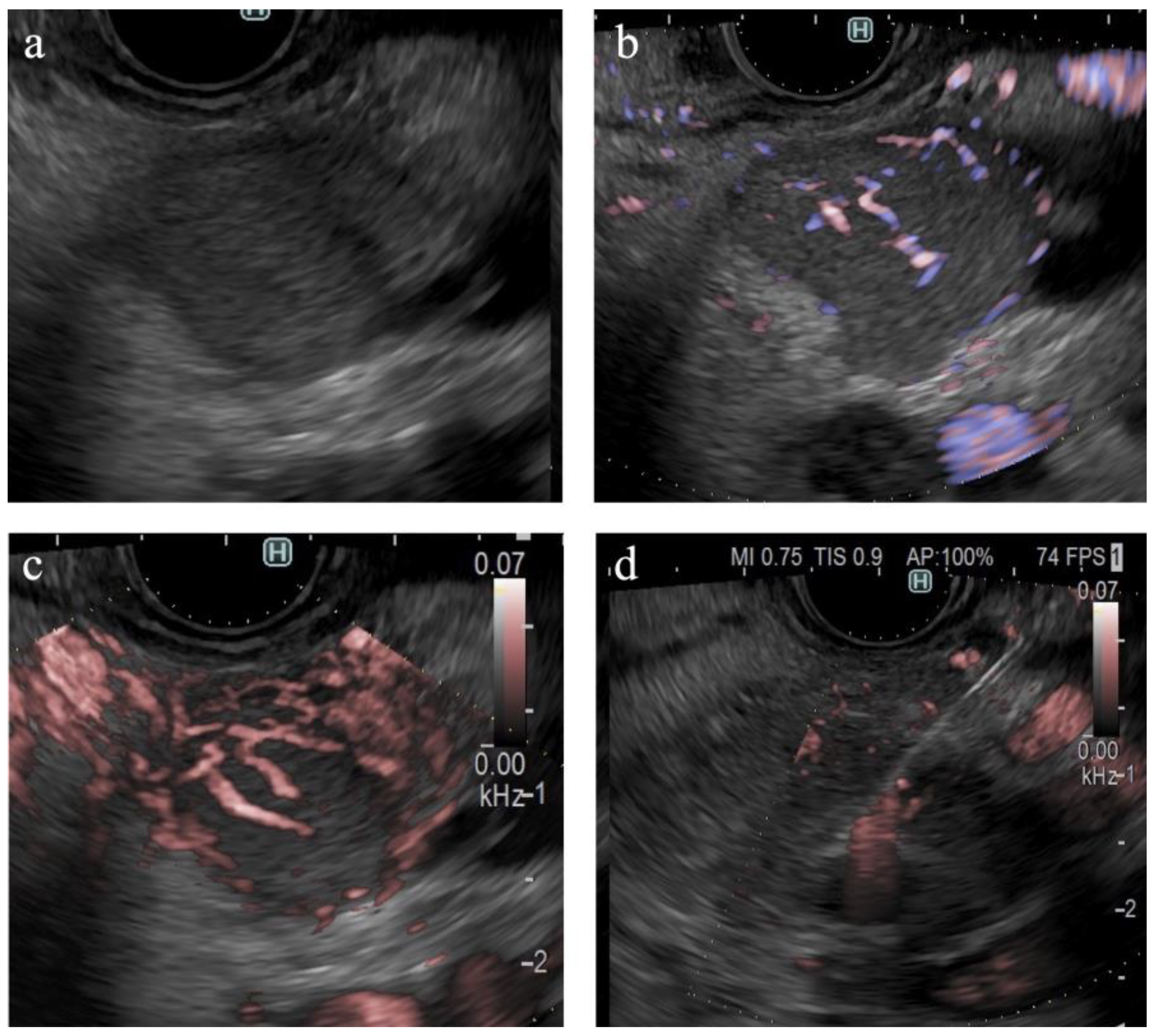 Diagnostics 14 00882 g006
