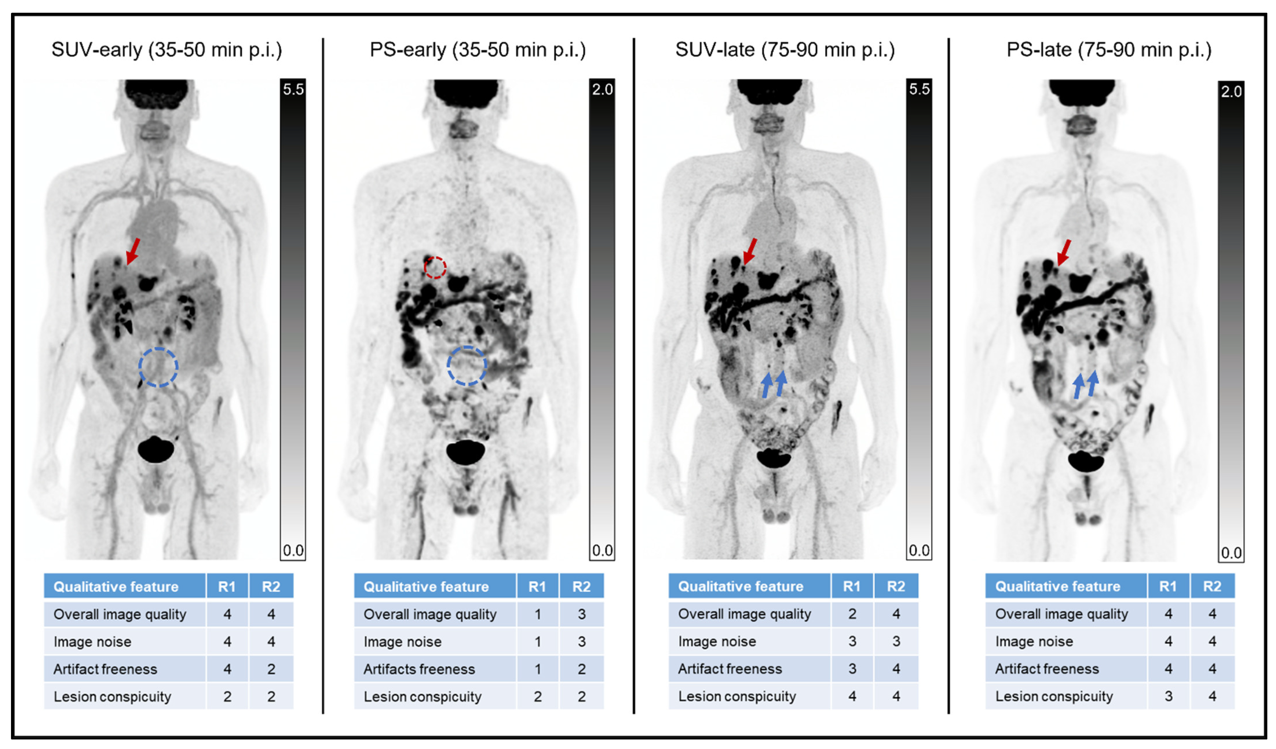 Diagnostics 14 00883 g006 Diagnostics 14 00883 g006