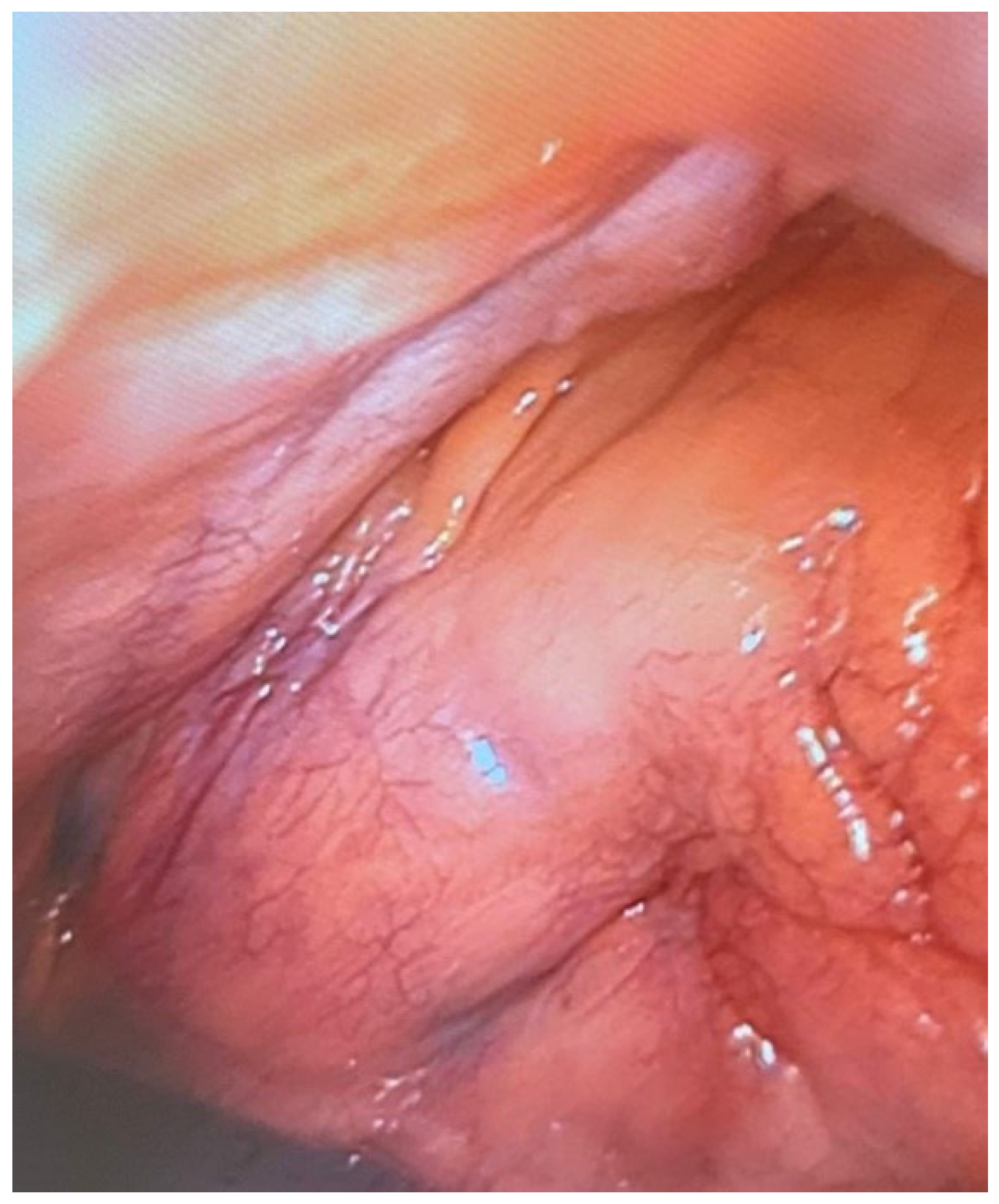 Diagnostics 14 00884 g006