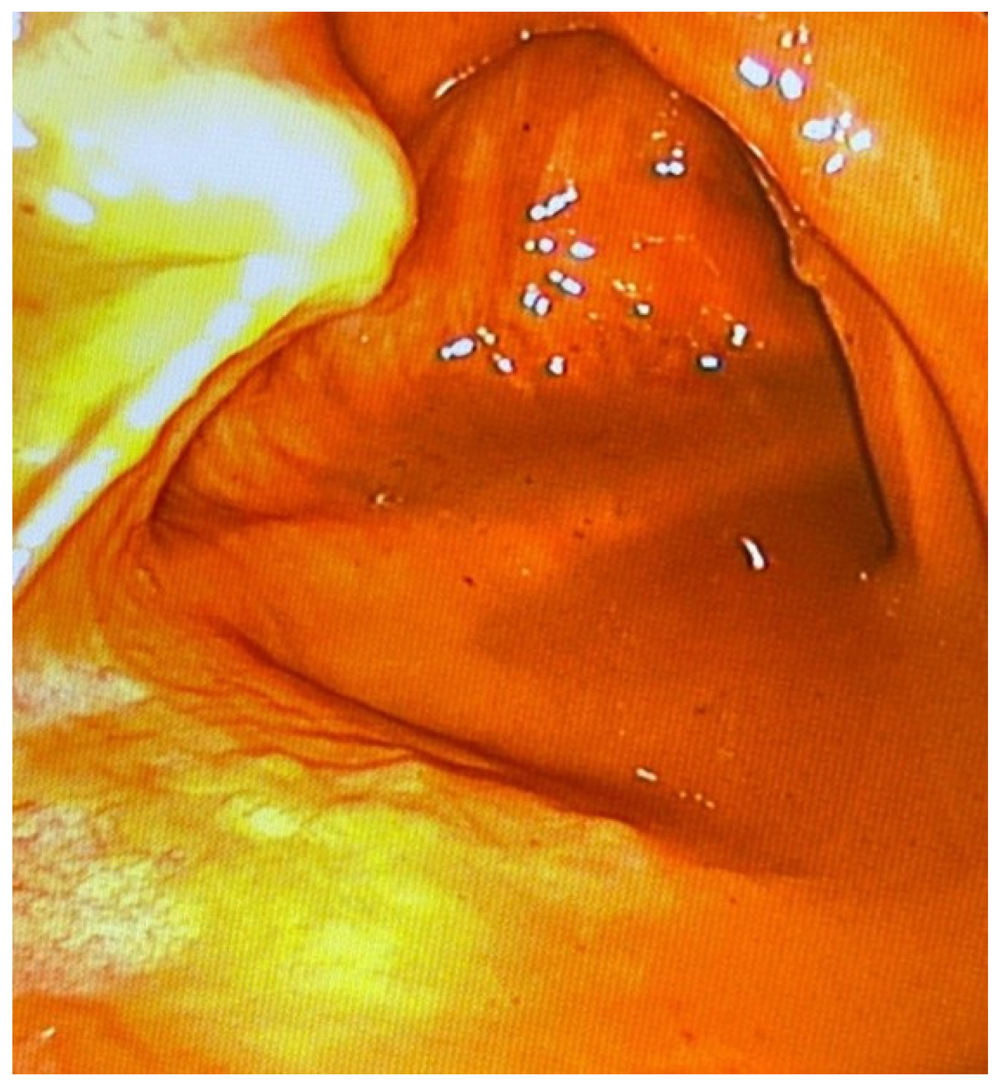 Diagnostics 14 00884 g007