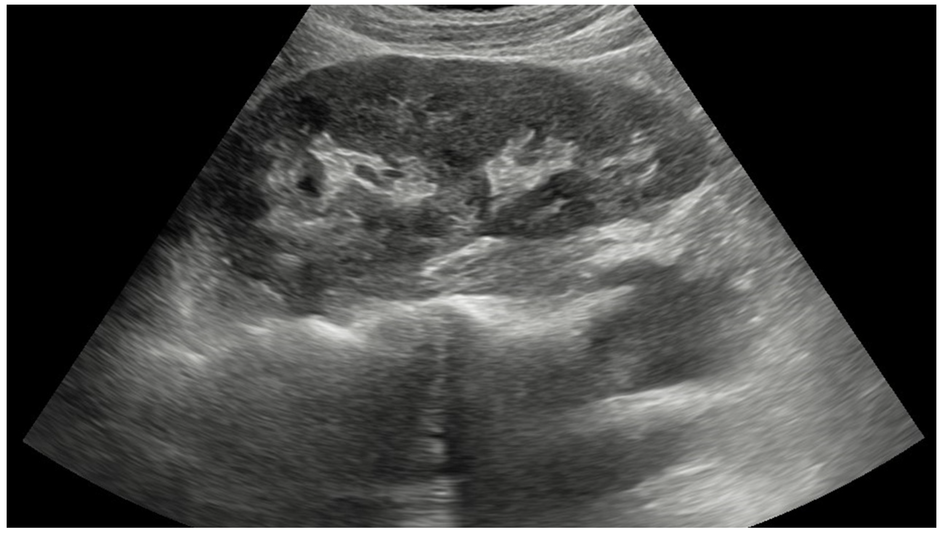 Diagnostics 14 00896 g001