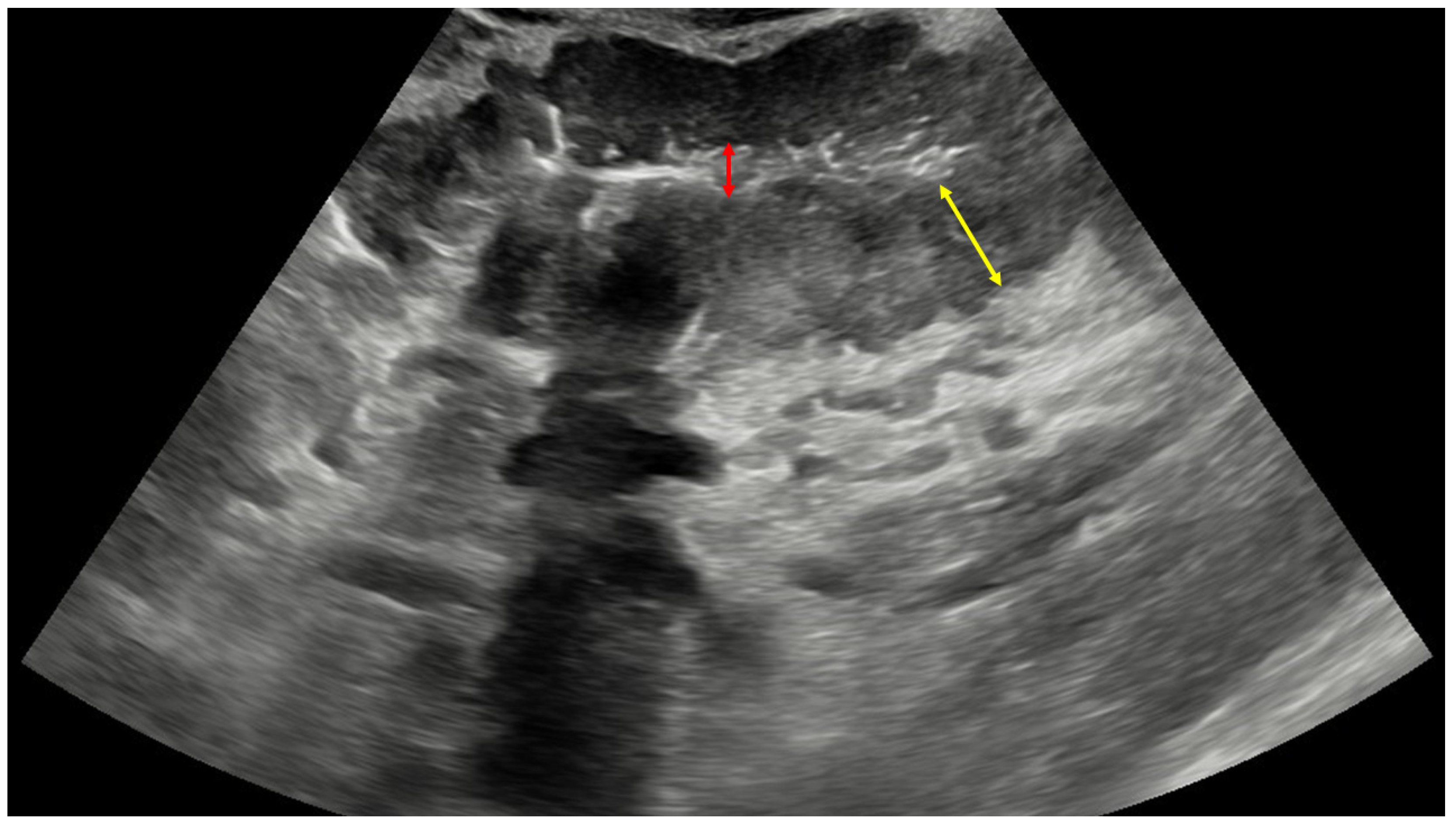 Diagnostics 14 00896 g002