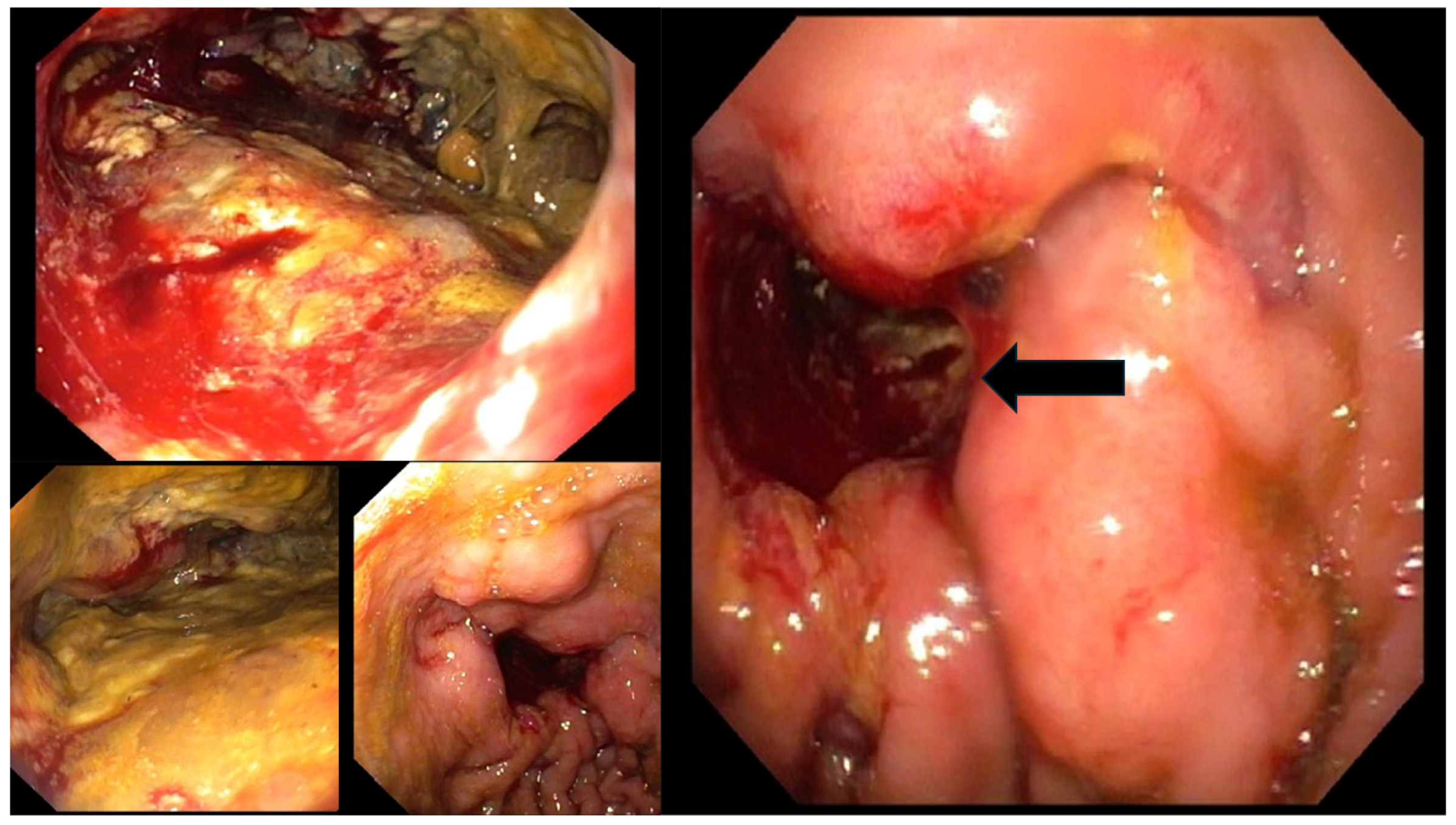 Diagnostics 14 00896 g003