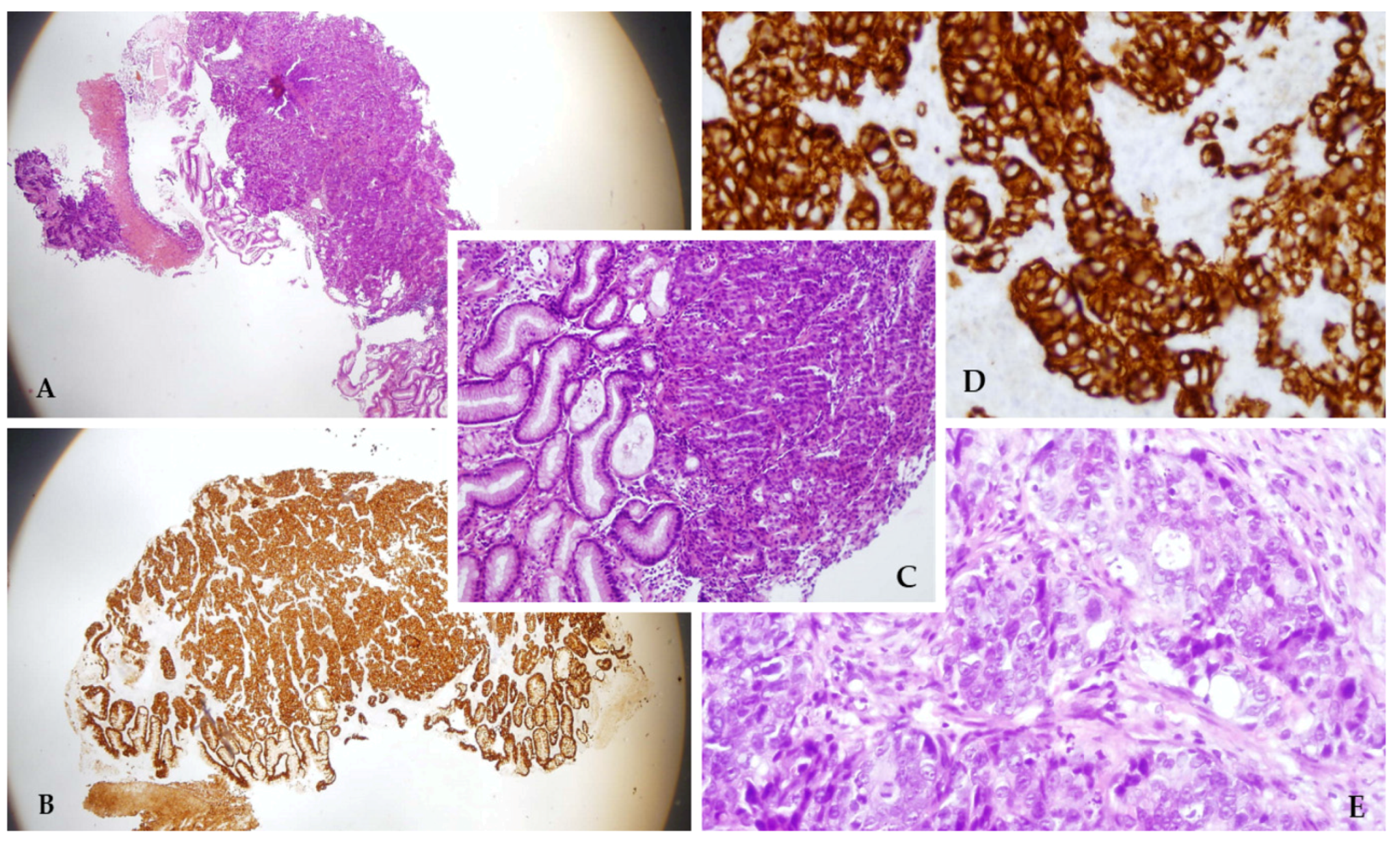 Diagnostics 14 00896 g004