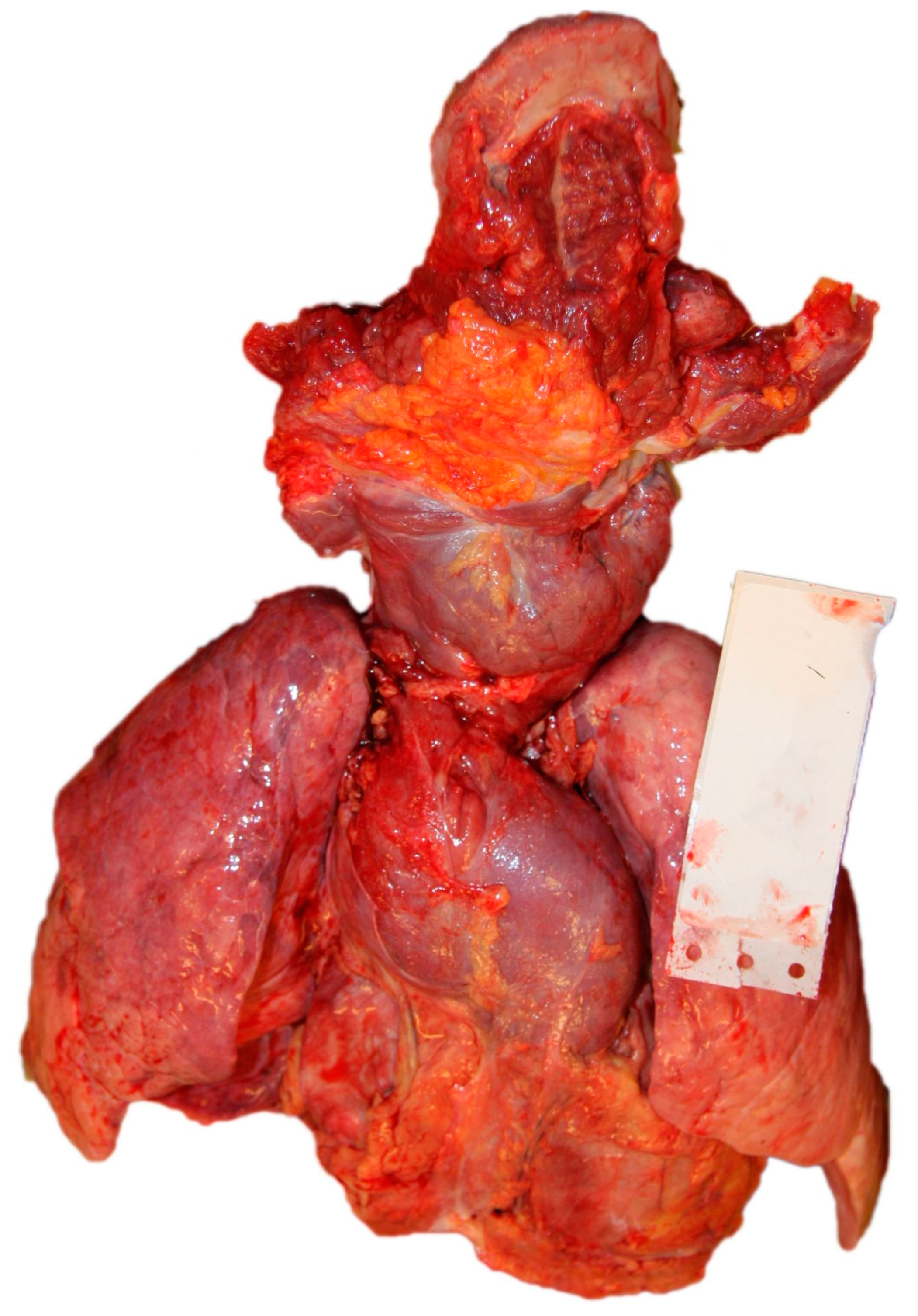 Diagnostics 14 00905 g002