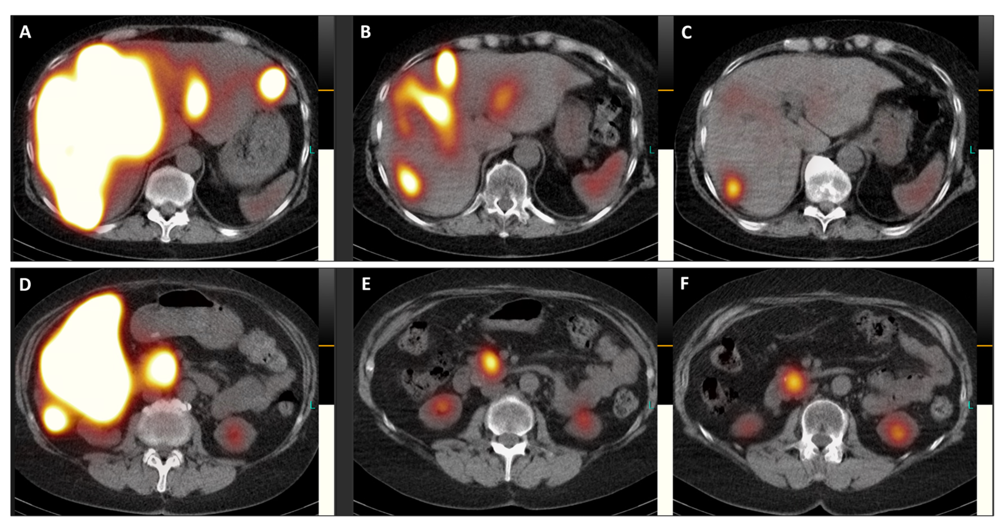 Diagnostics 14 00907 g005