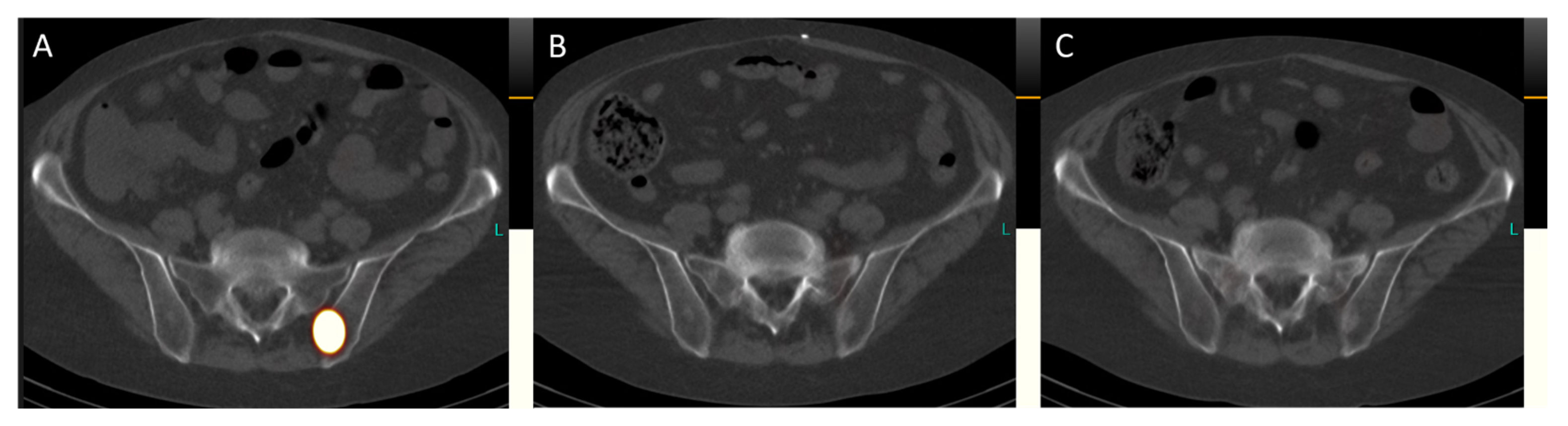 Diagnostics 14 00907 g006