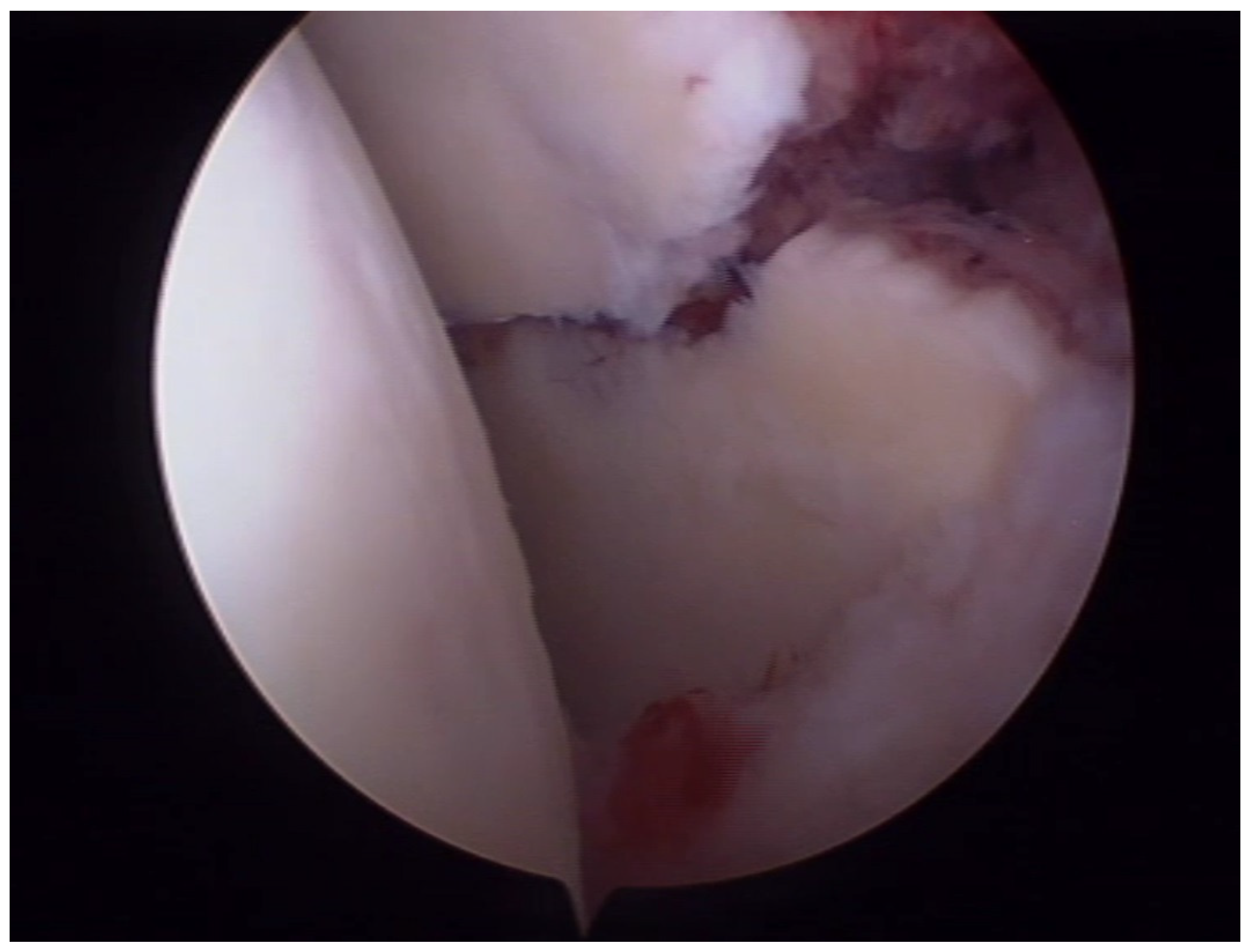 Diagnostics 14 00908 g003