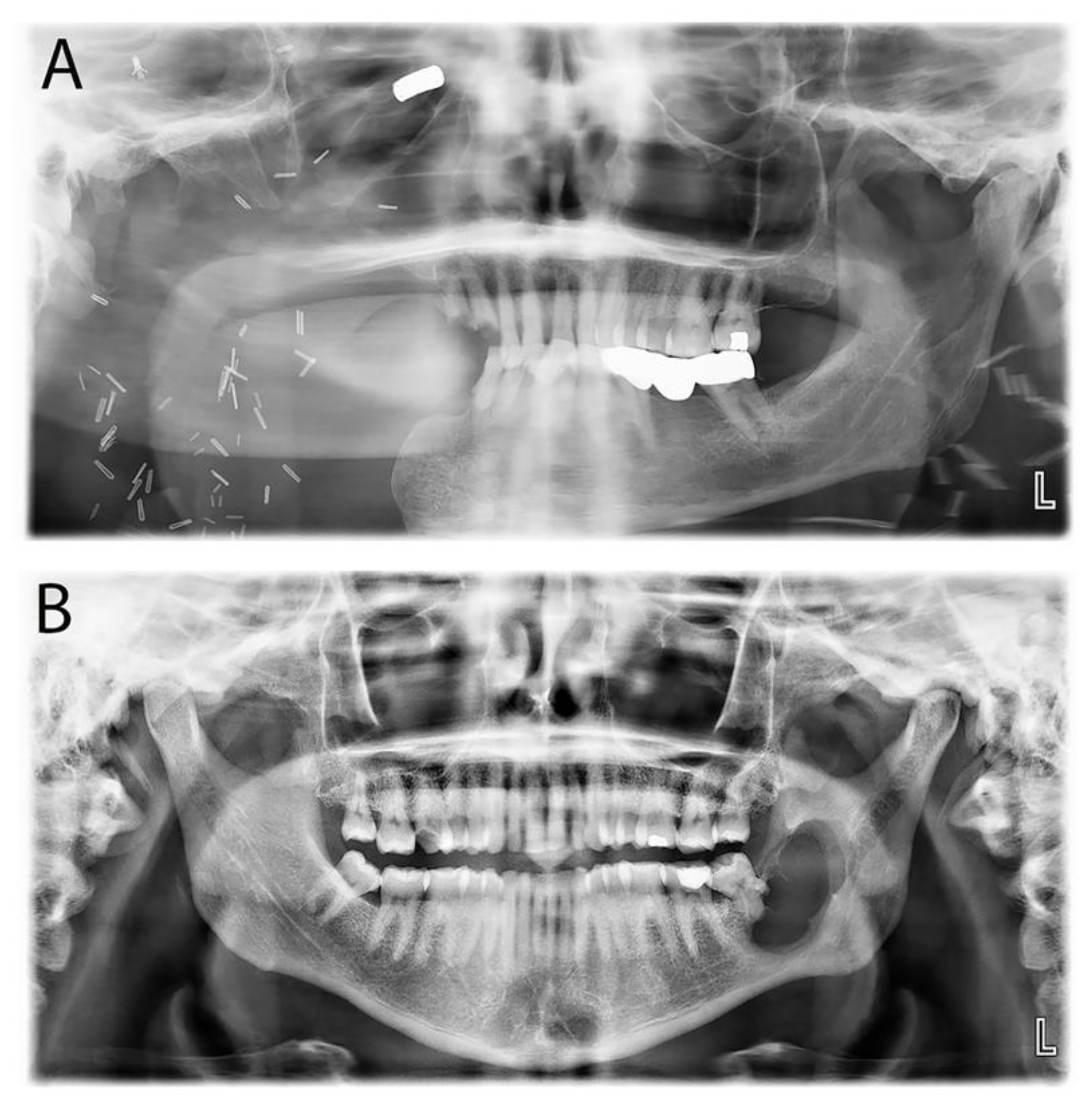 Diagnostics 14 00910 g006